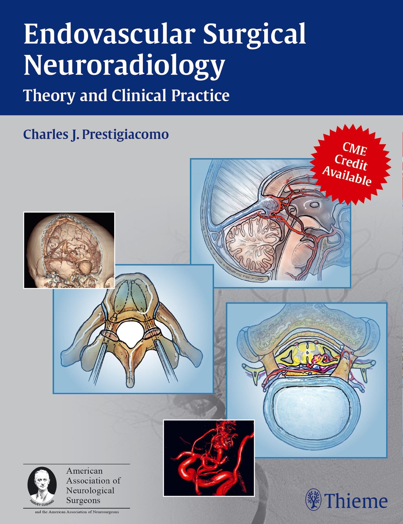 Endovascular Surgical Neuroradiology