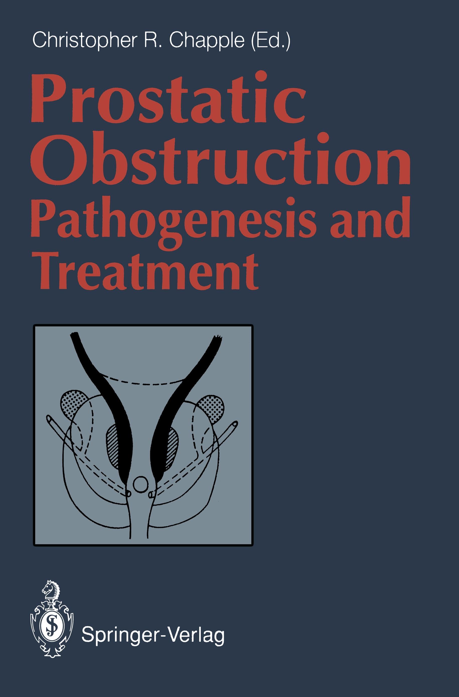 Prostatic Obstruction