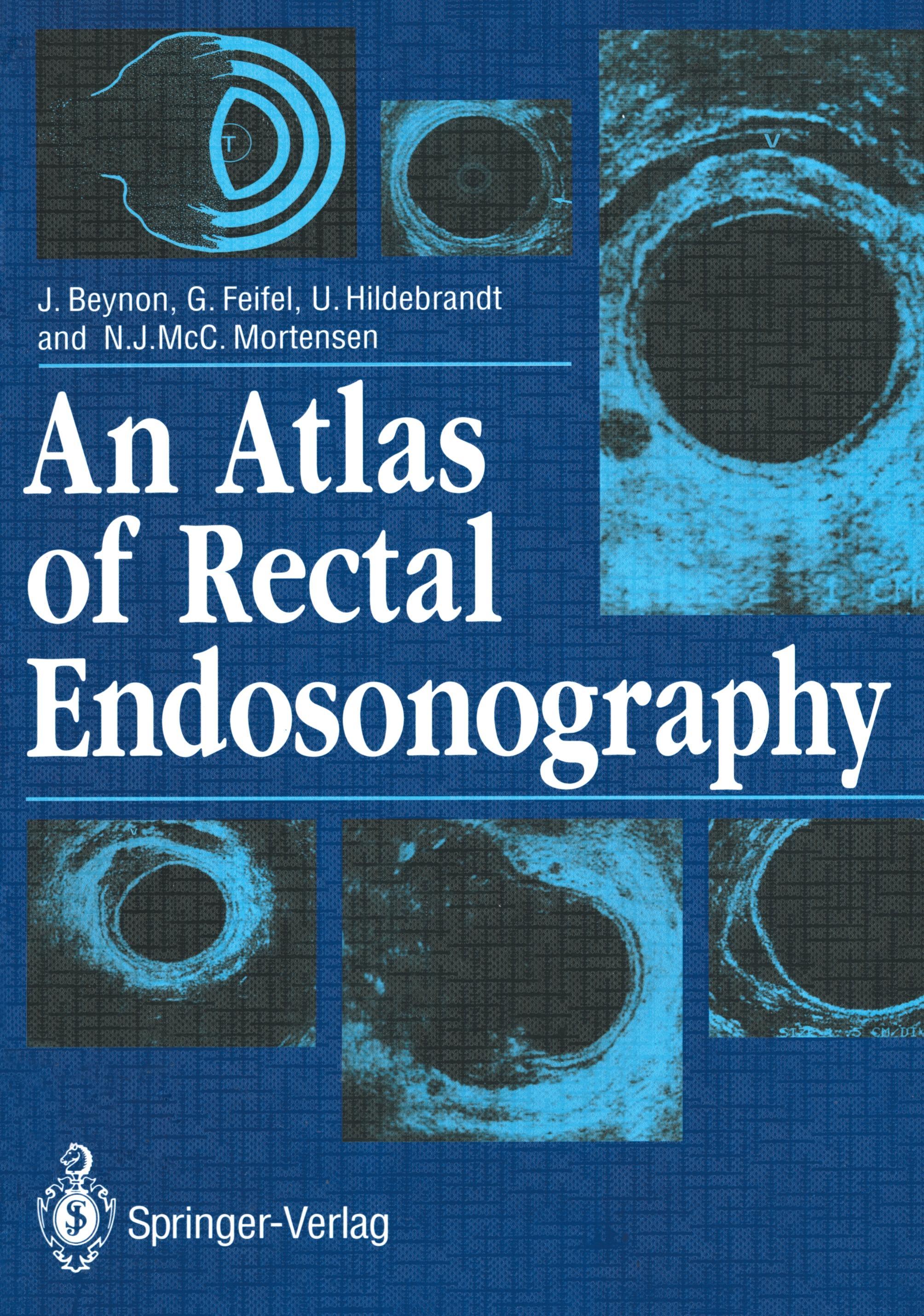 An Atlas of Rectal Endosonography