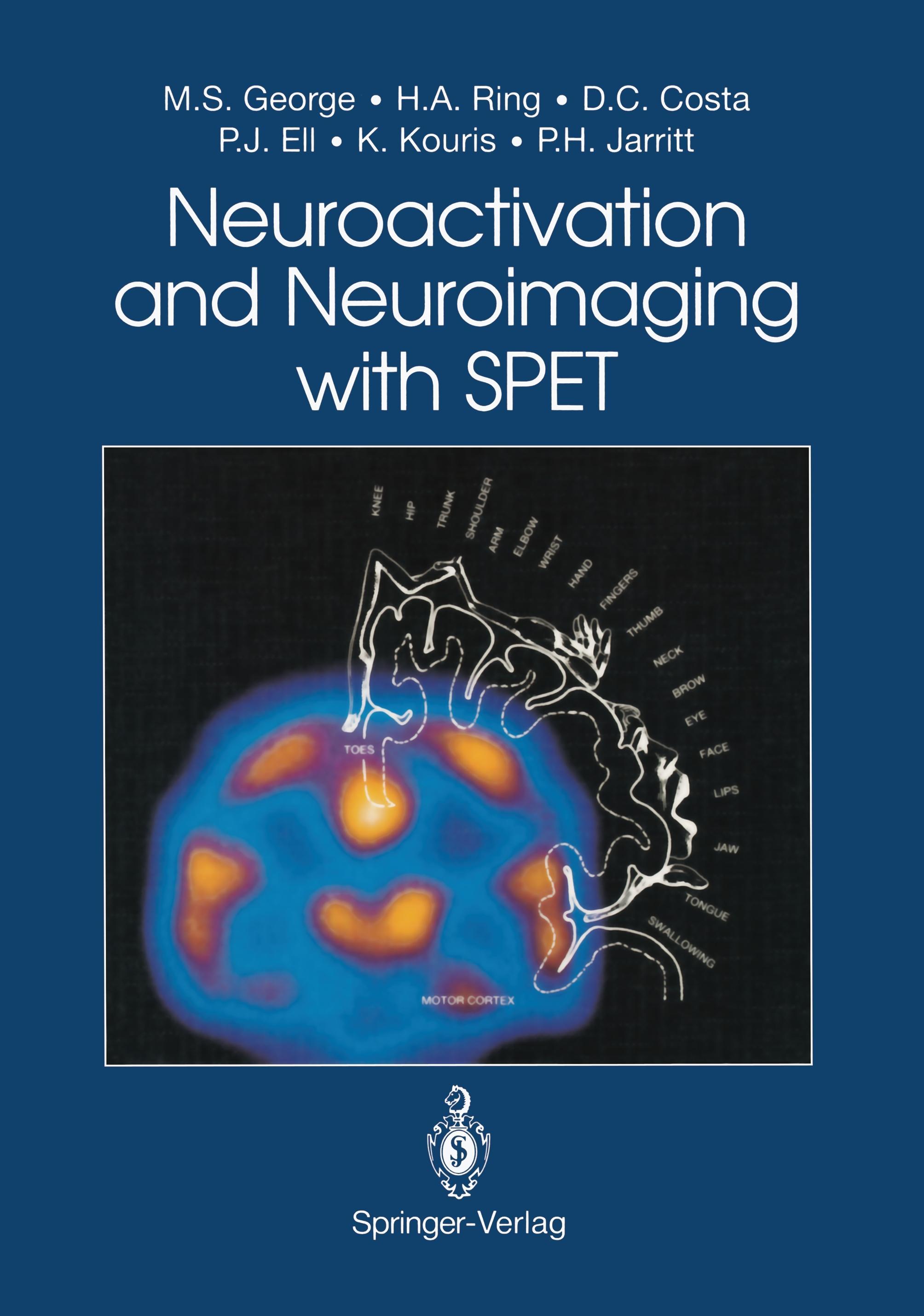 Neuroactivation and Neuroimaging with SPET