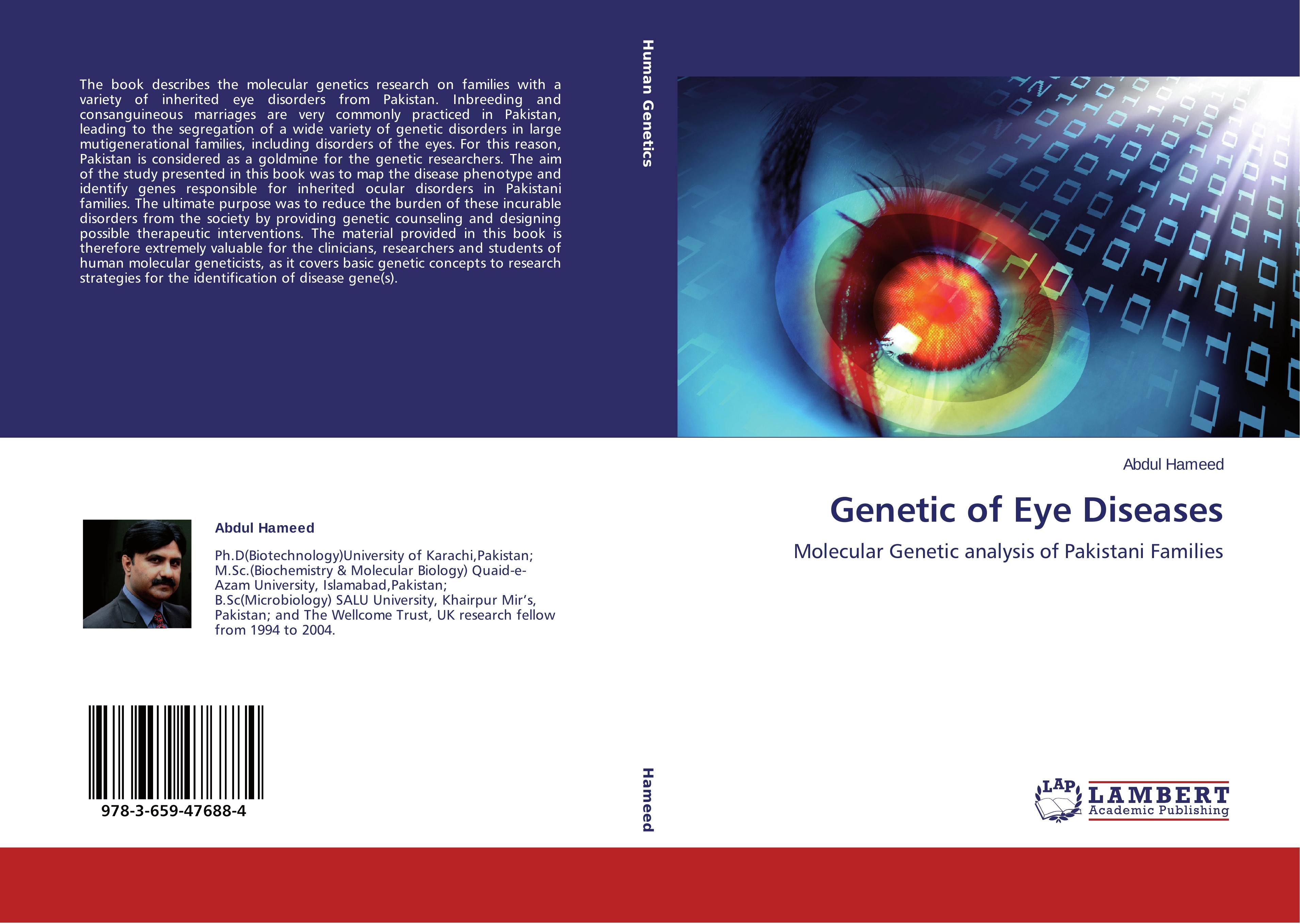 Genetic of Eye Diseases