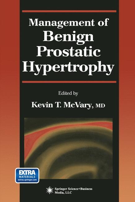 Management of Benign Prostatic Hypertrophy