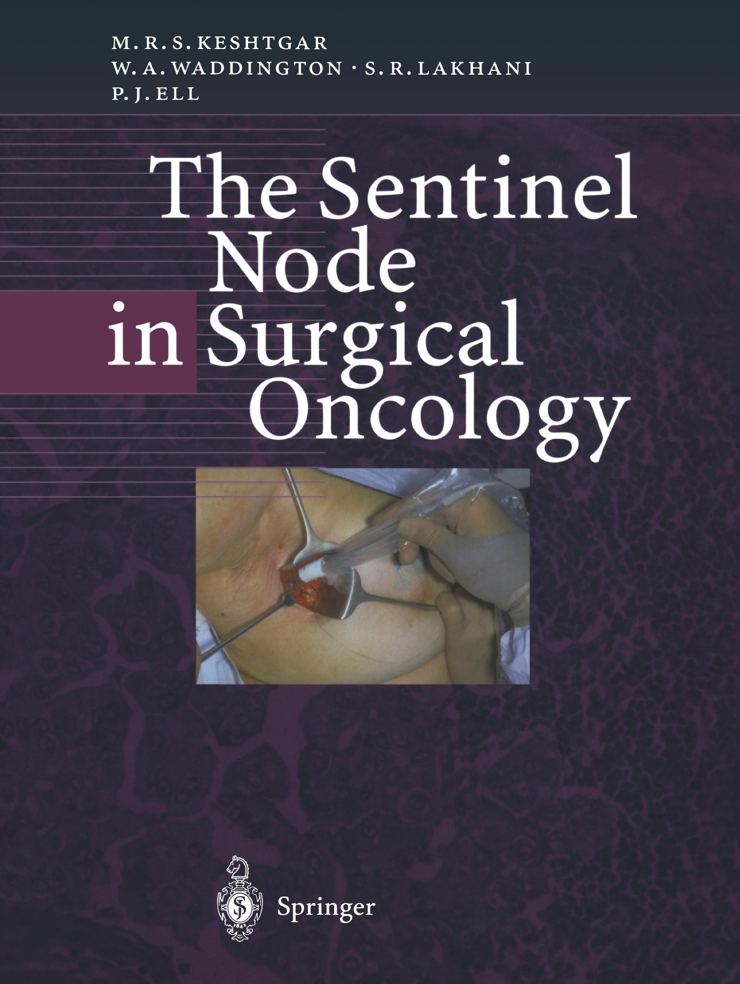 The Sentinel Node in Surgical Oncology