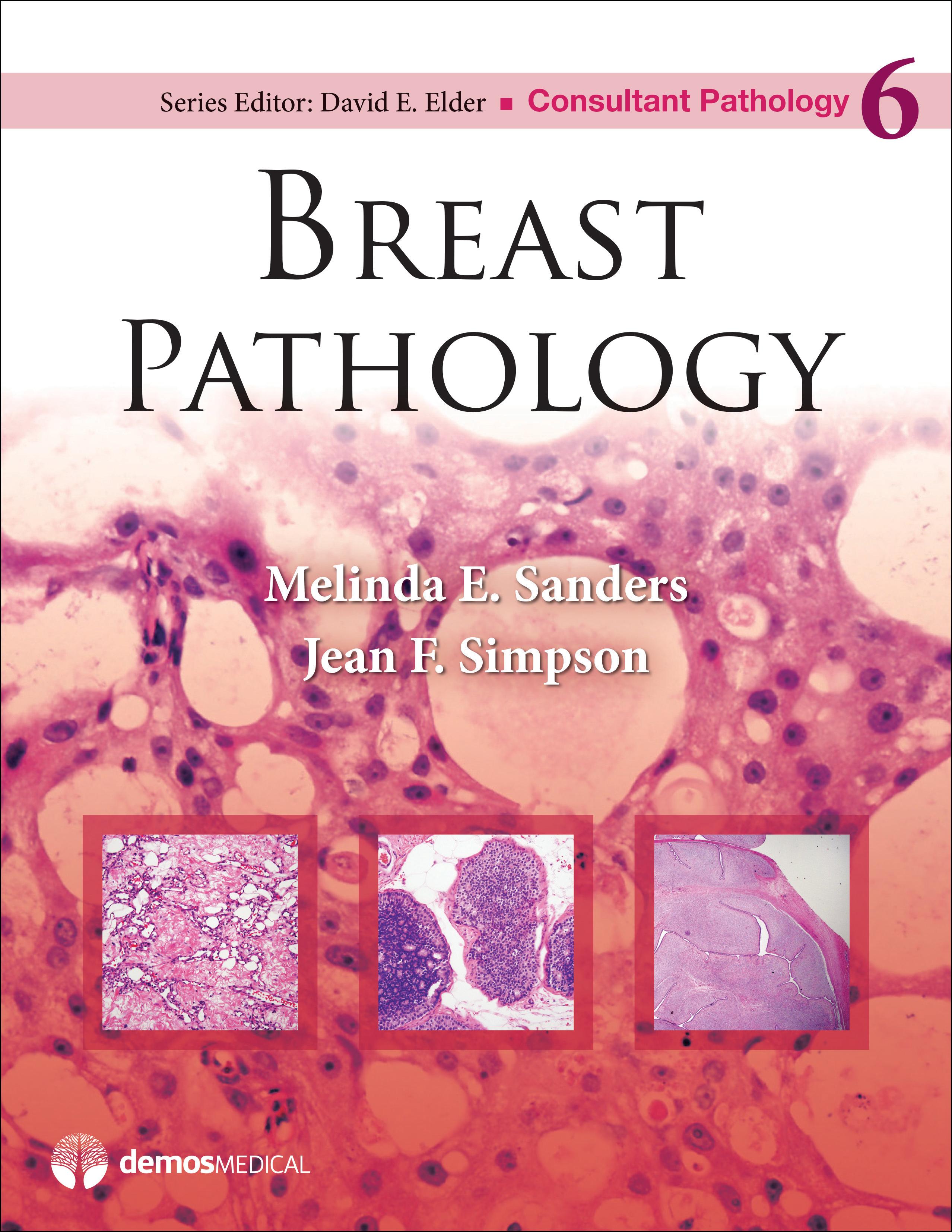 Breast Pathology