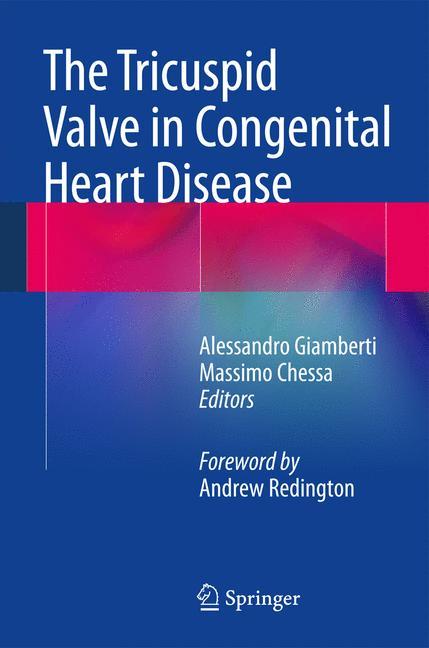 The Tricuspid Valve in Congenital Heart Disease