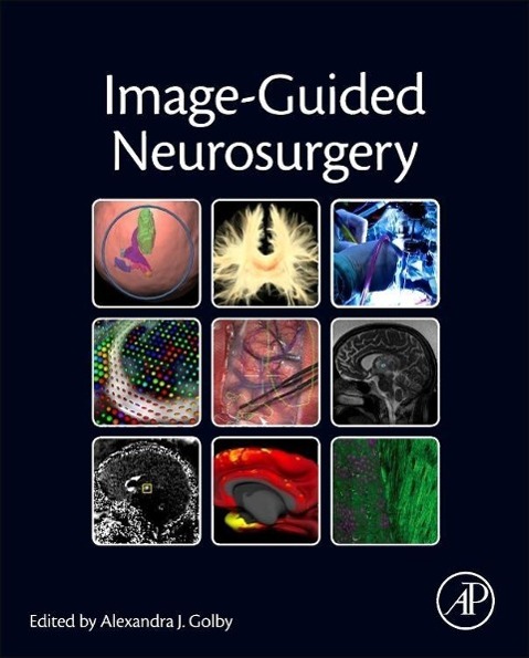 Image-Guided Neurosurgery