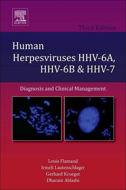 Human Herpesviruses Hhv-6a, Hhv-6b and Hhv-7