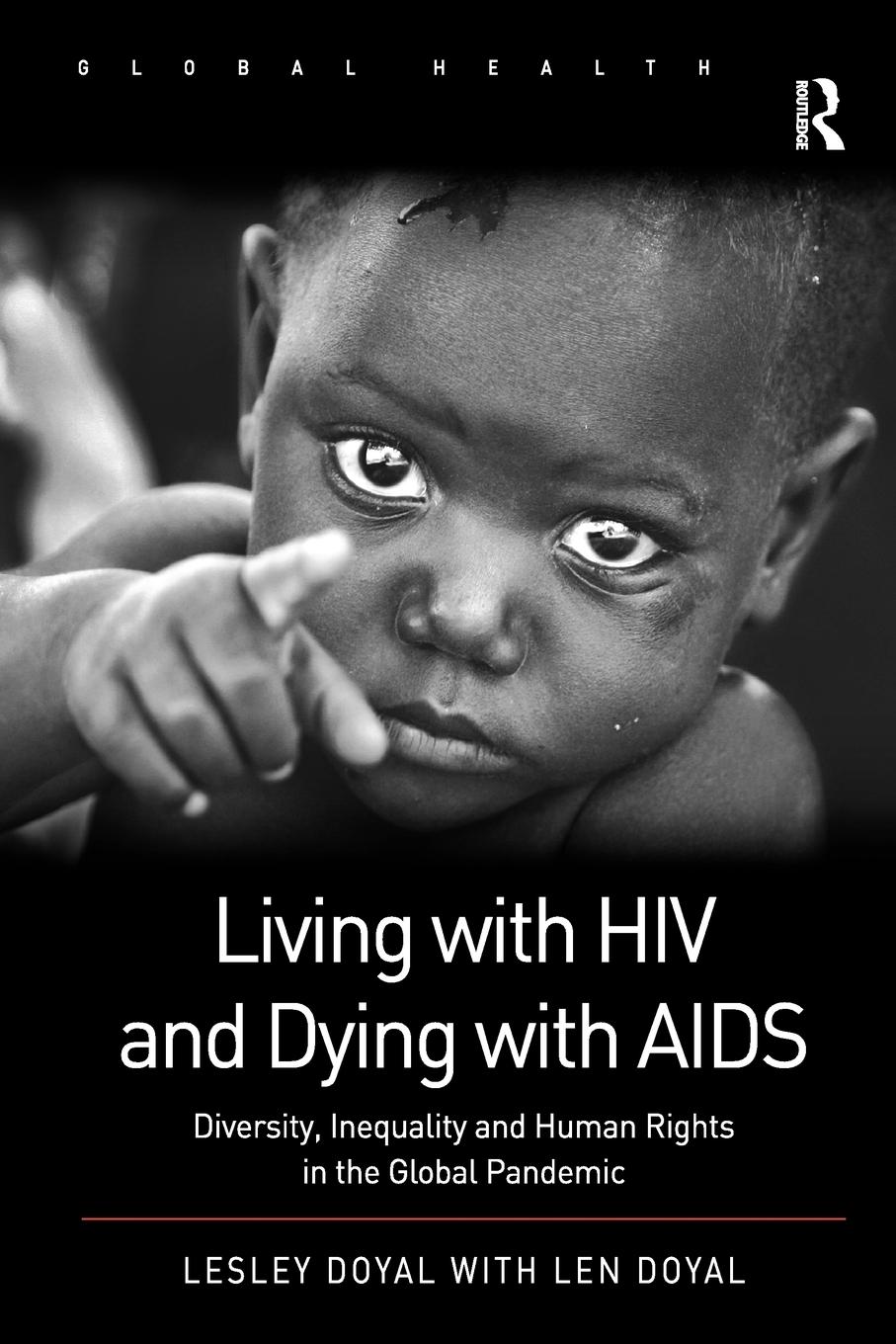 Living with HIV and Dying with AIDS