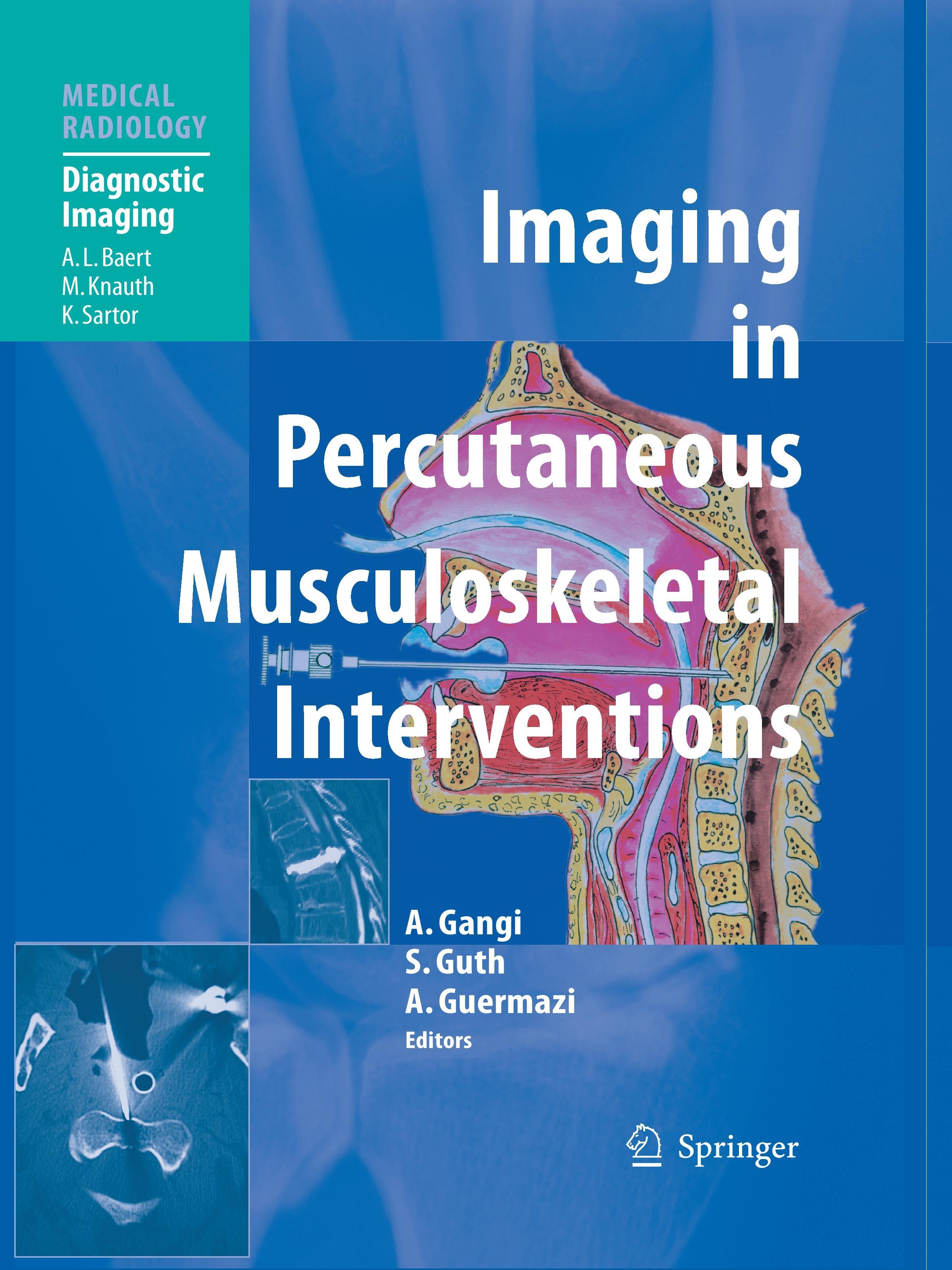 Imaging in Percutaneous Musculoskeletal Interventions