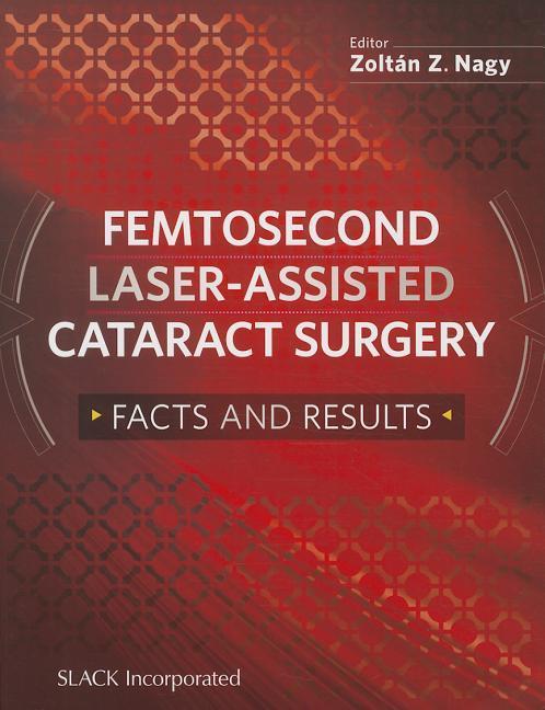 Femtosecond Laser-Assisted Cataract Surgery