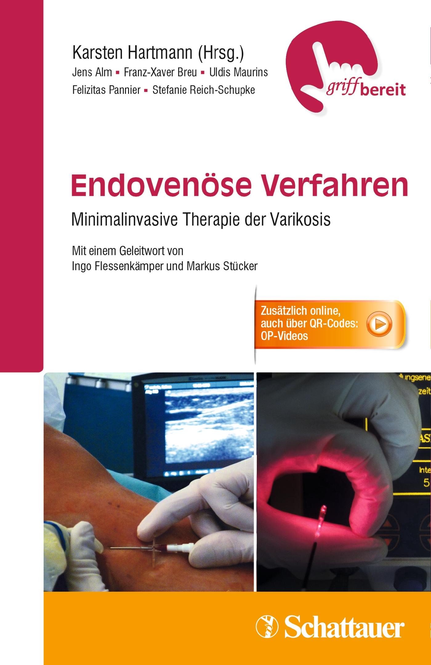 Endovenöse Verfahren