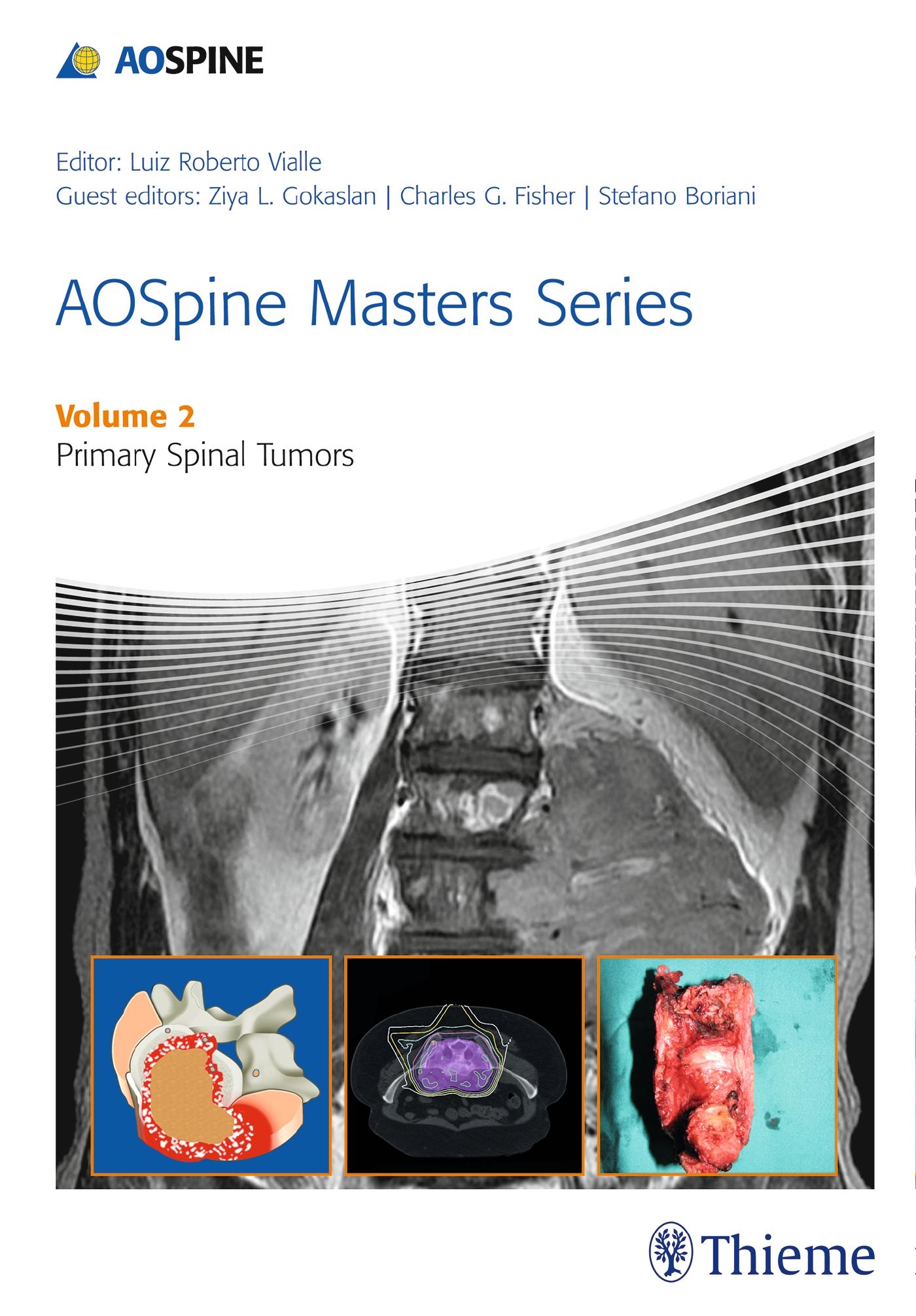 Aospine Masters Series Volume 2: Primary Spinal Tumors