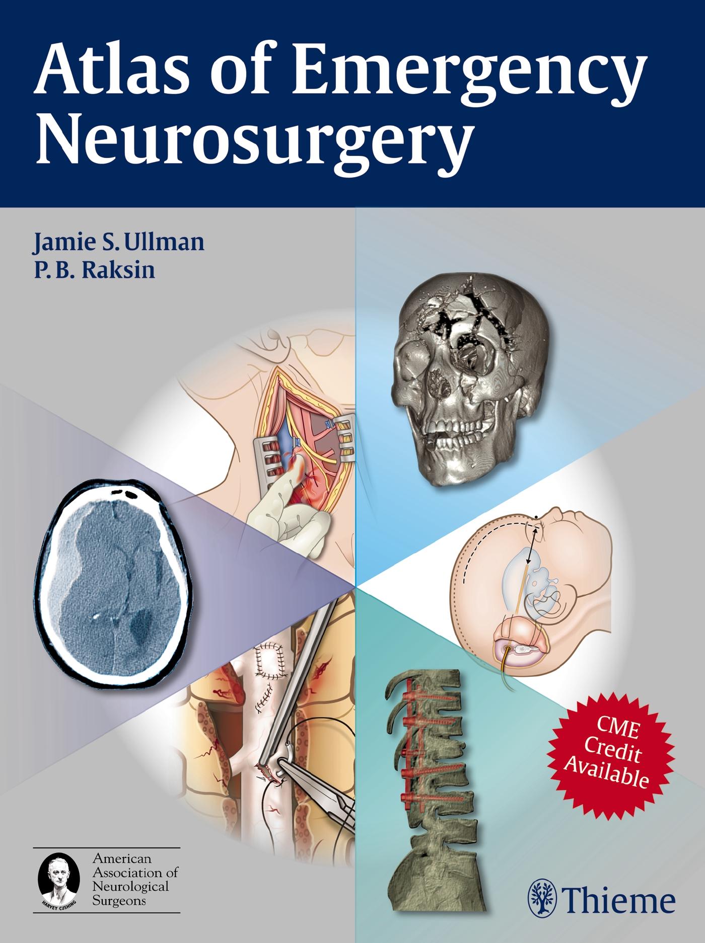 Atlas of Emergency Neurosurgery