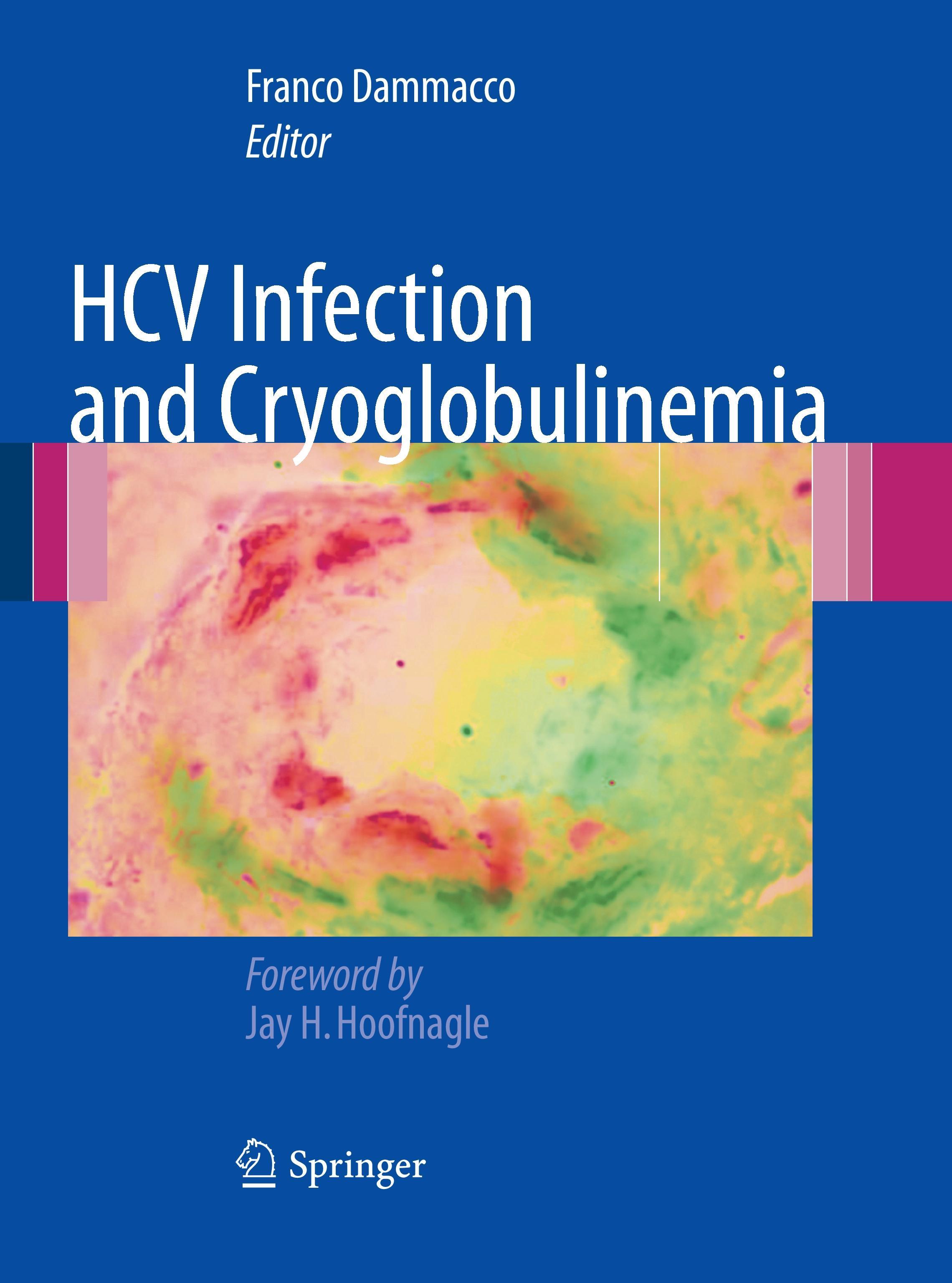 HCV Infection and Cryoglobulinemia