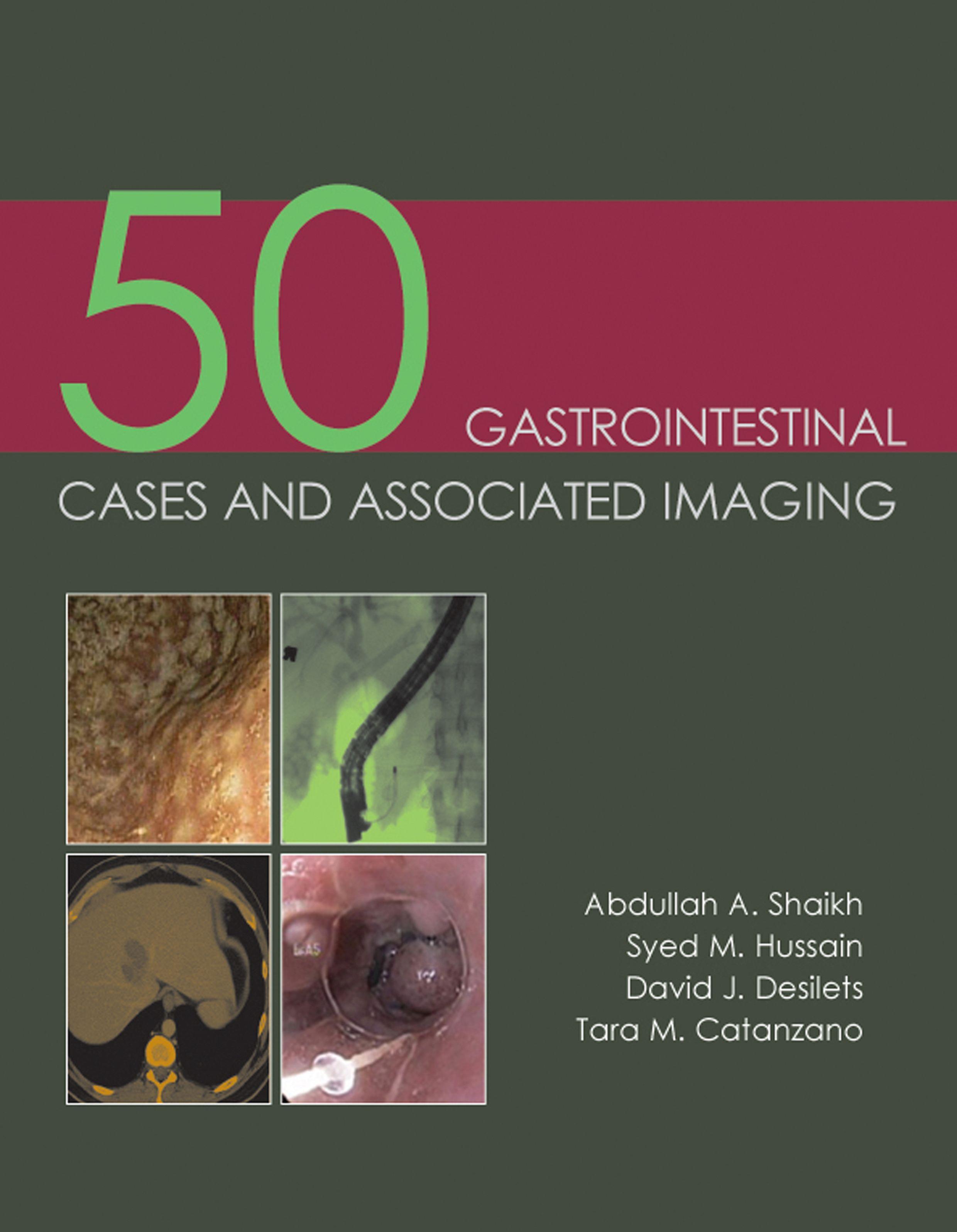 50 Gastrointestinal Cases and Associated Imaging