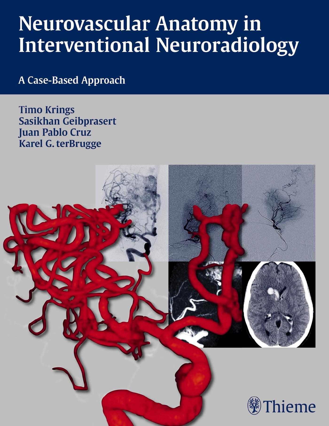 Neurovascular Anatomy in Interventional Neuroradiology