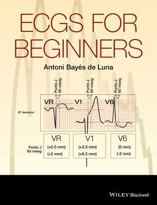 Ecgs for Beginners