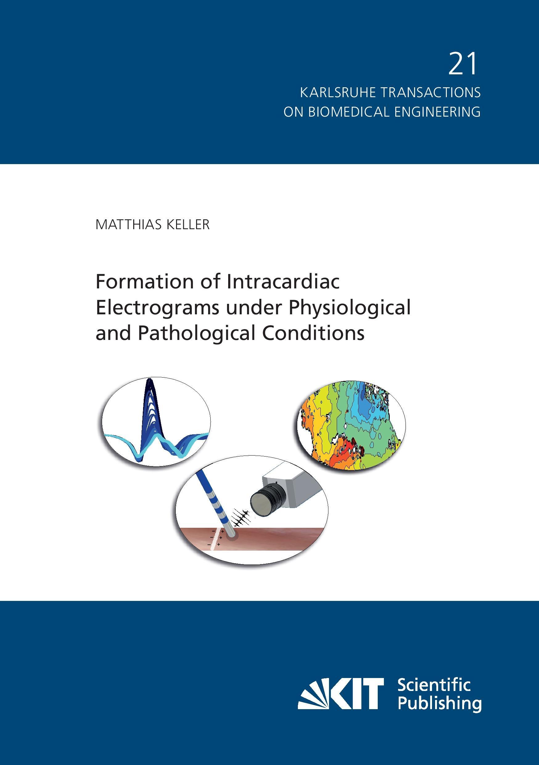 Formation of Intracardiac Electrograms under Physiological and Pathological Conditions