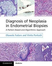 Diagnosis of Neoplasia in Endometrial Biopsies Book and Online Bundle