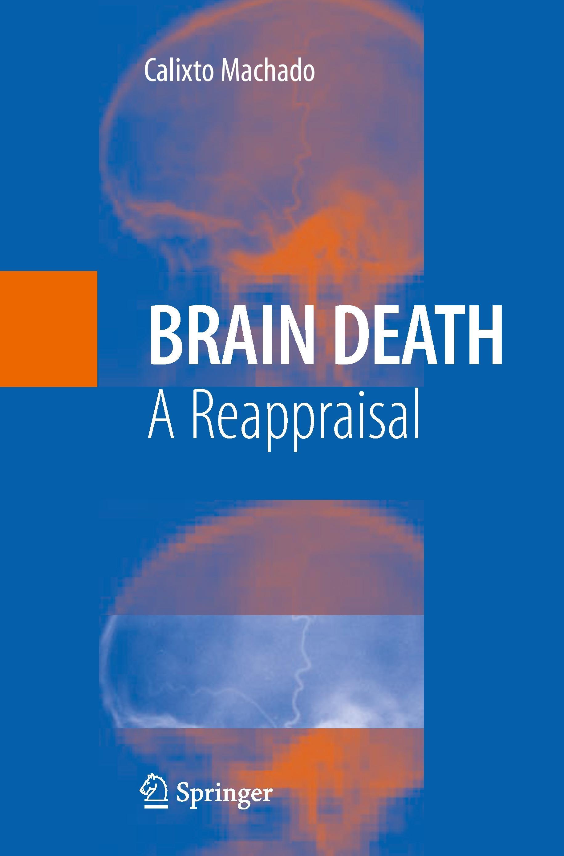 Brain Death