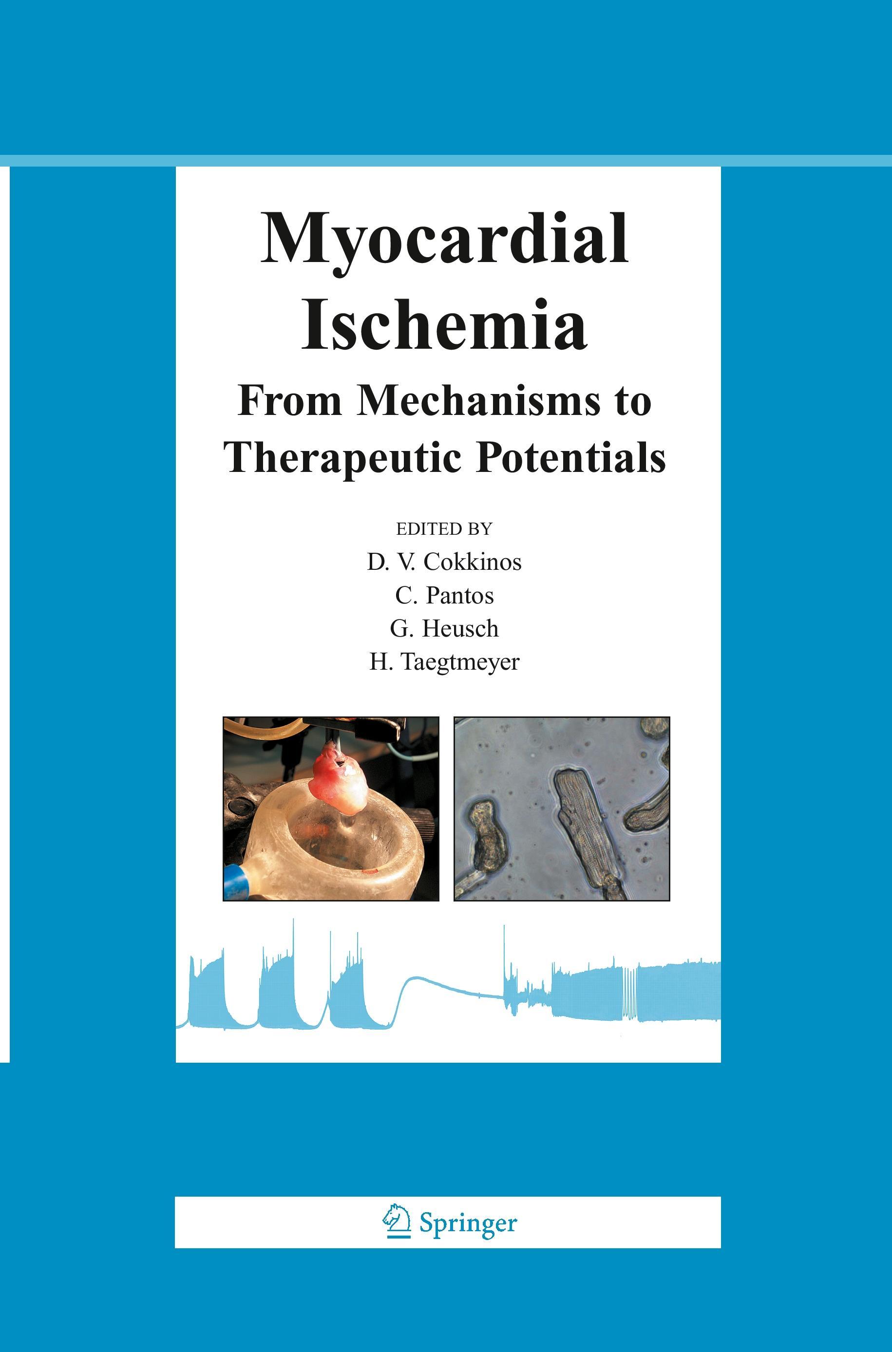 Myocardial Ischemia