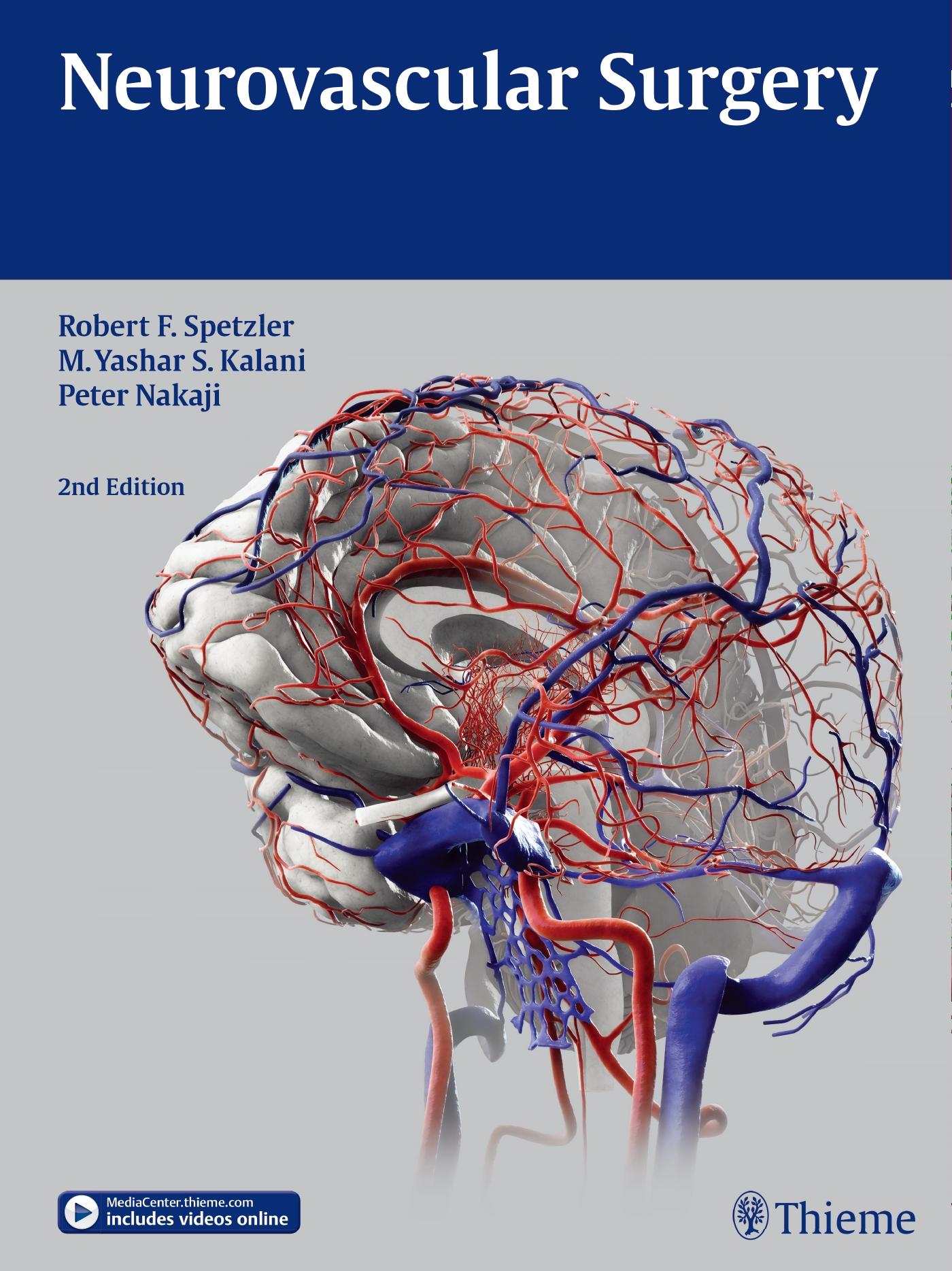 Neurovascular Surgery