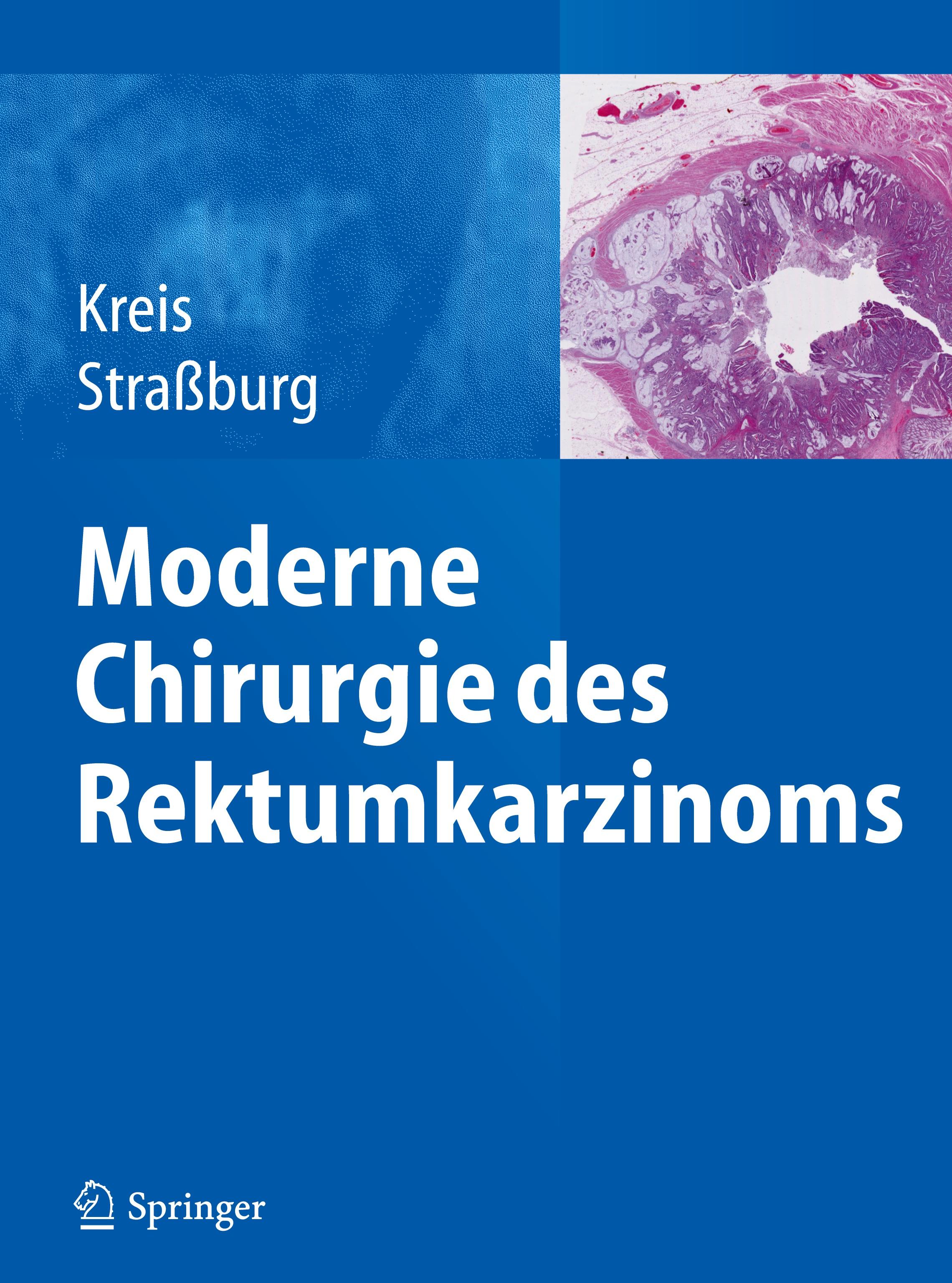 Moderne Chirurgie des Rektumkarzinoms