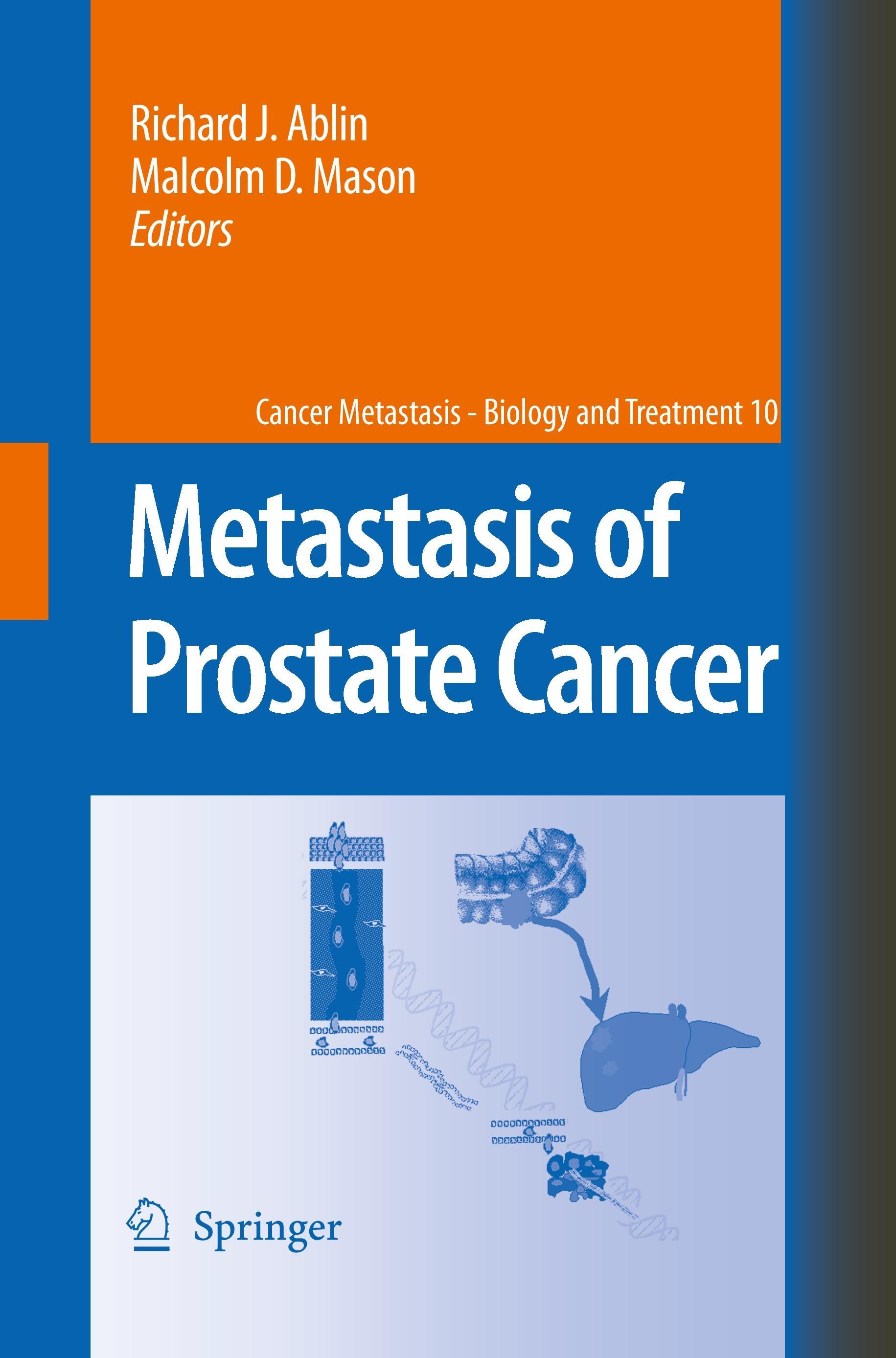 Metastasis of Prostate Cancer