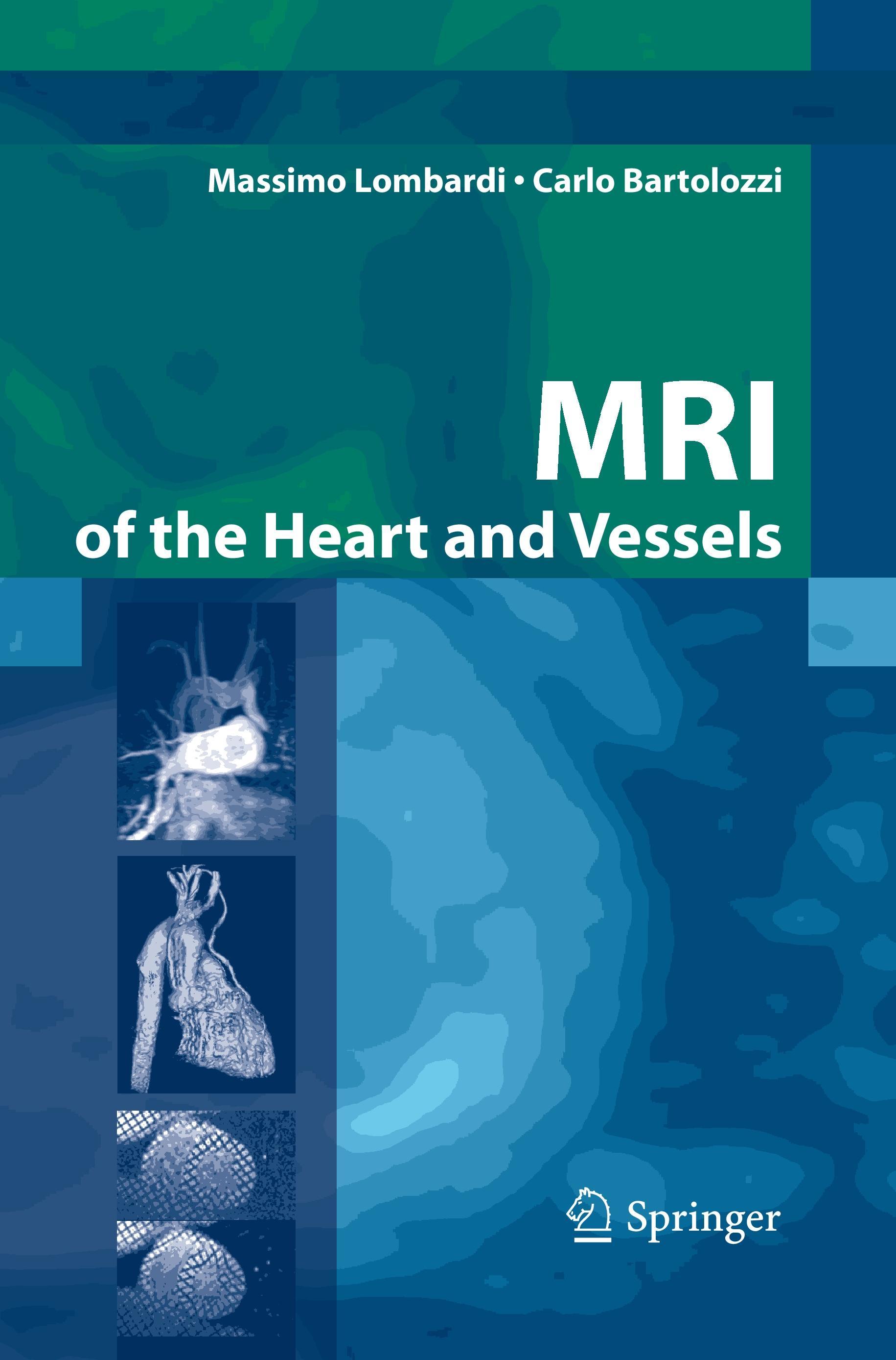 MRI of the Heart and Vessels