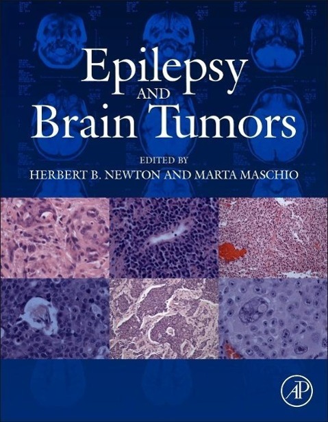 Epilepsy and Brain Tumors