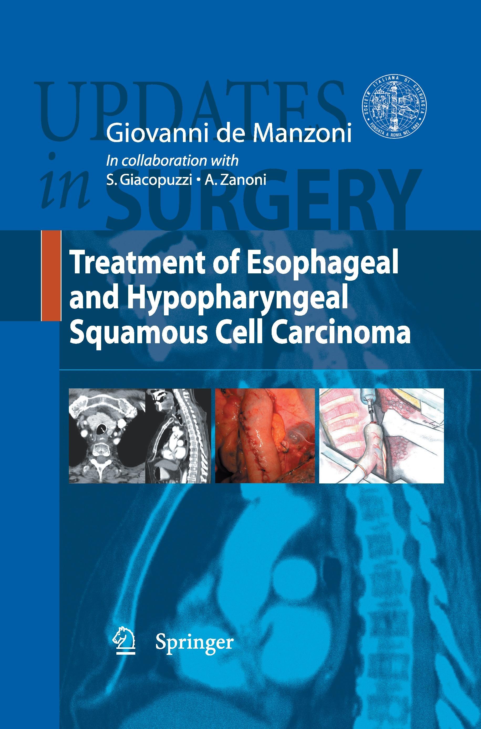 Treatment of Esophageal and Hypopharingeal Squamous Cell Carcinoma