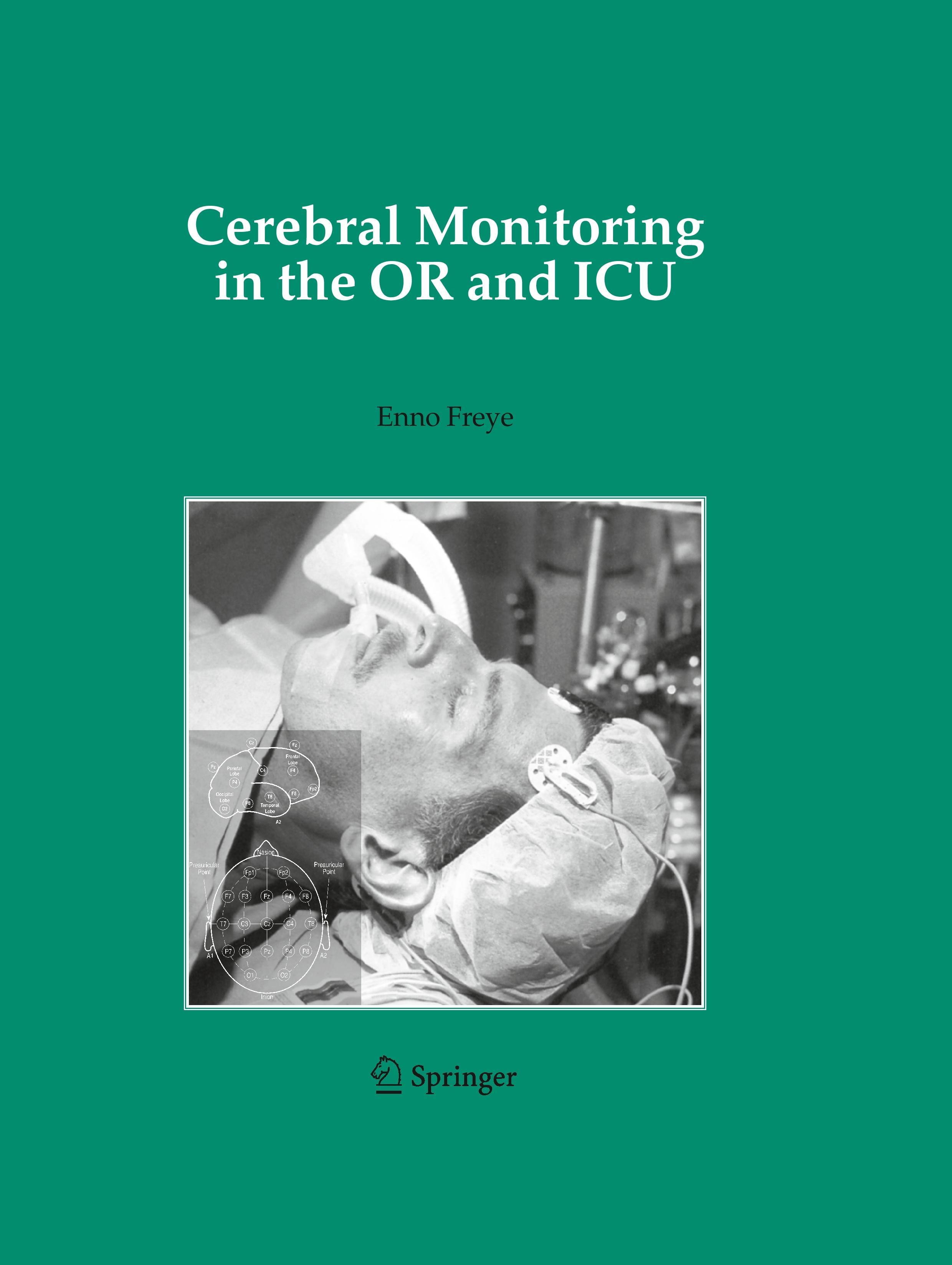 Cerebral Monitoring in the OR and ICU