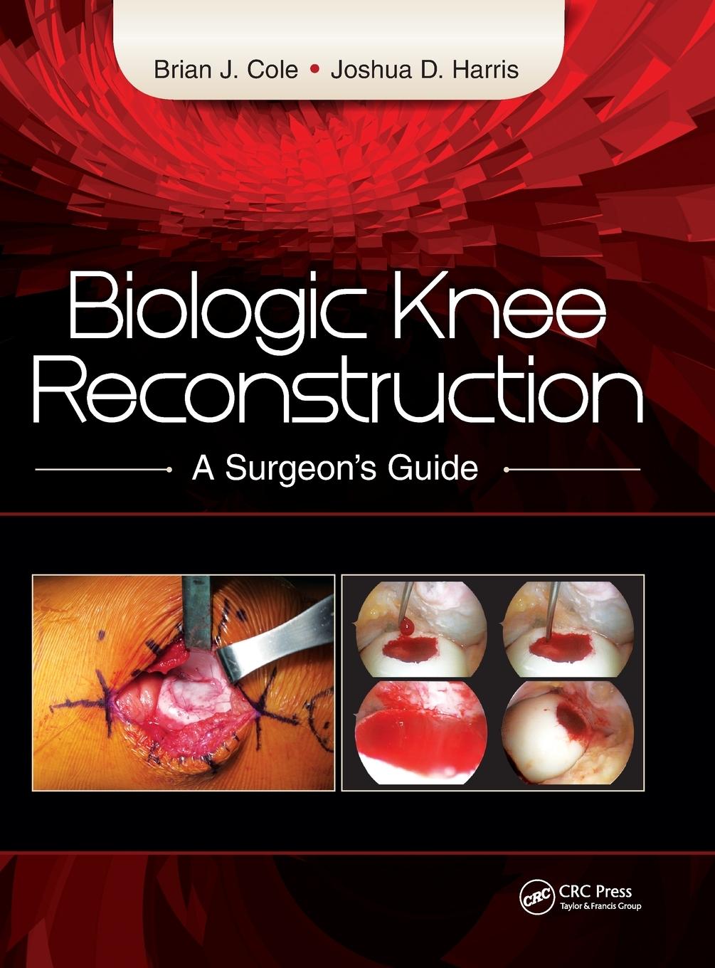 Biologic Knee Reconstruction