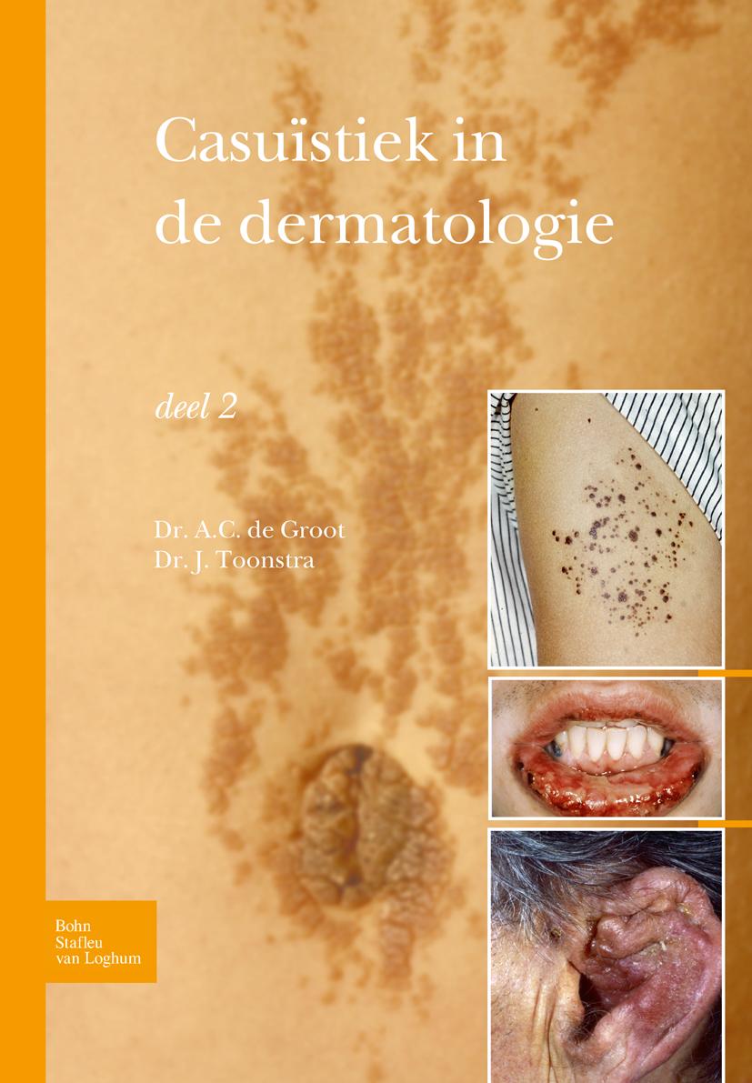 Casuïstiek in de Dermatologie - Deel 2