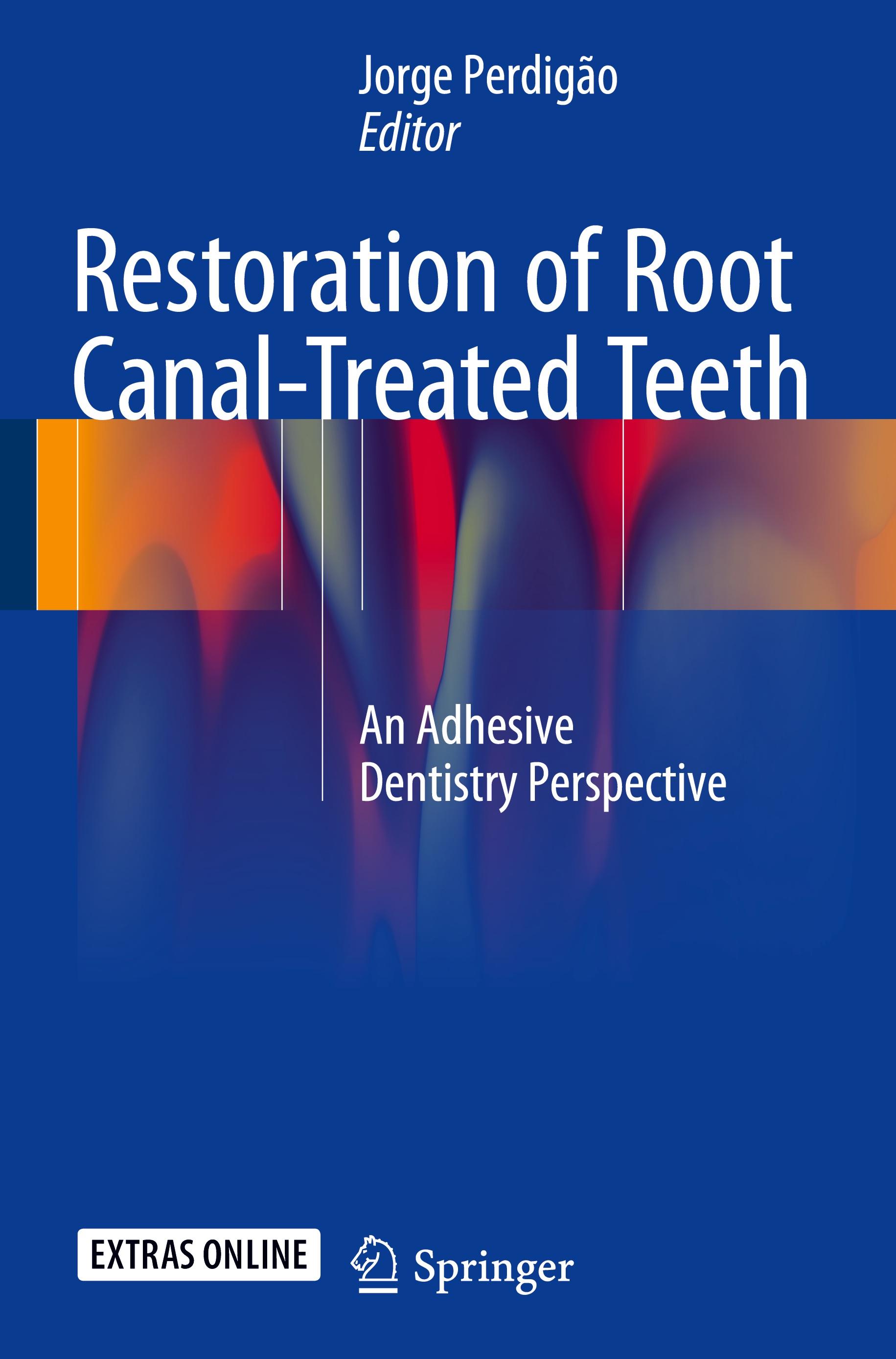 Restoration of Root Canal-Treated Teeth