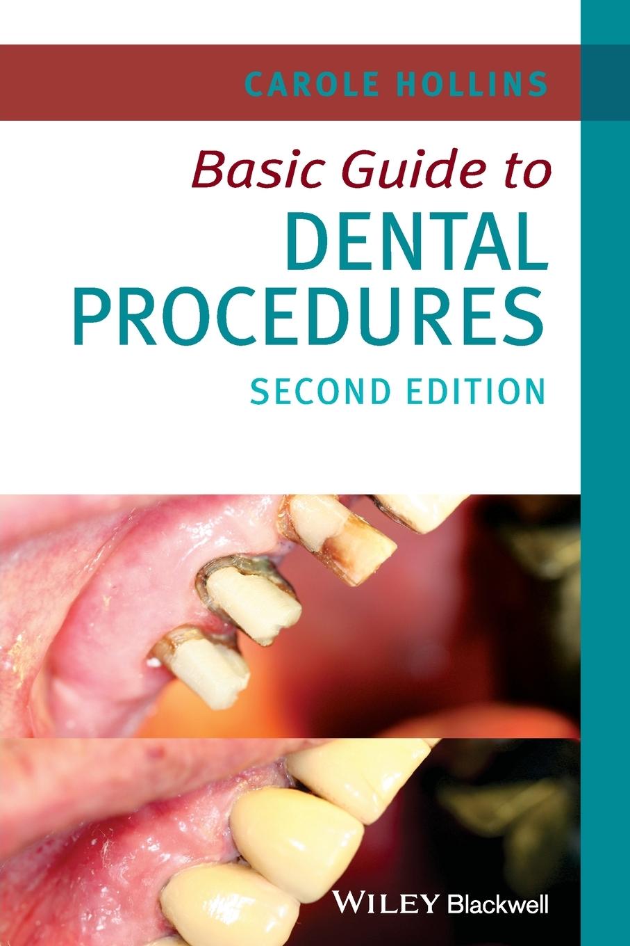 Basic Guide to Dental Procedures