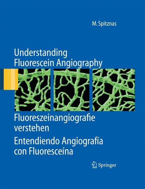 Understanding Fluorescein Angiography, Fluoreszeinangiografie verstehen, Entendiendo Angiografía con Fluoresceína