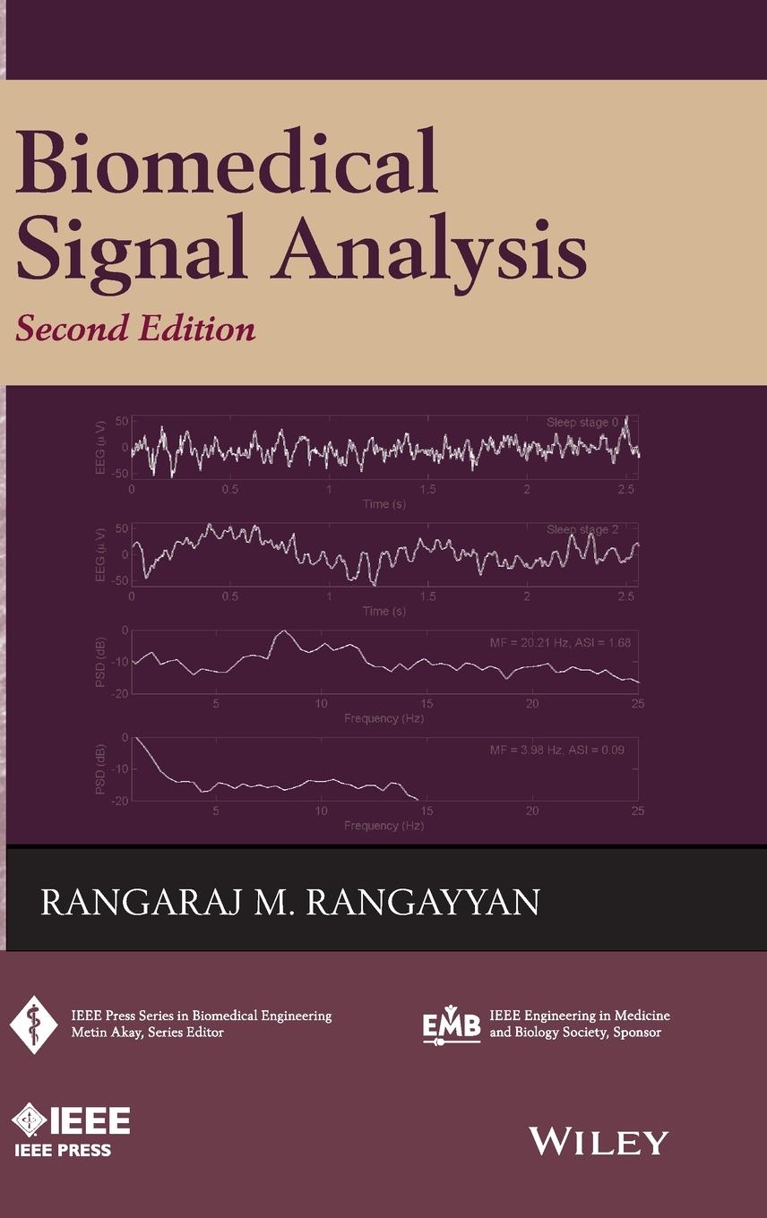 Biomedical Signal Analysis