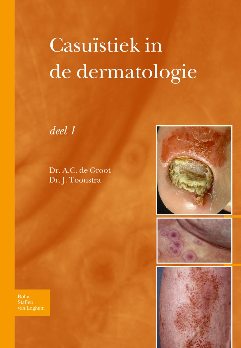 Casuïstiek in de Dermatologie - Deel I