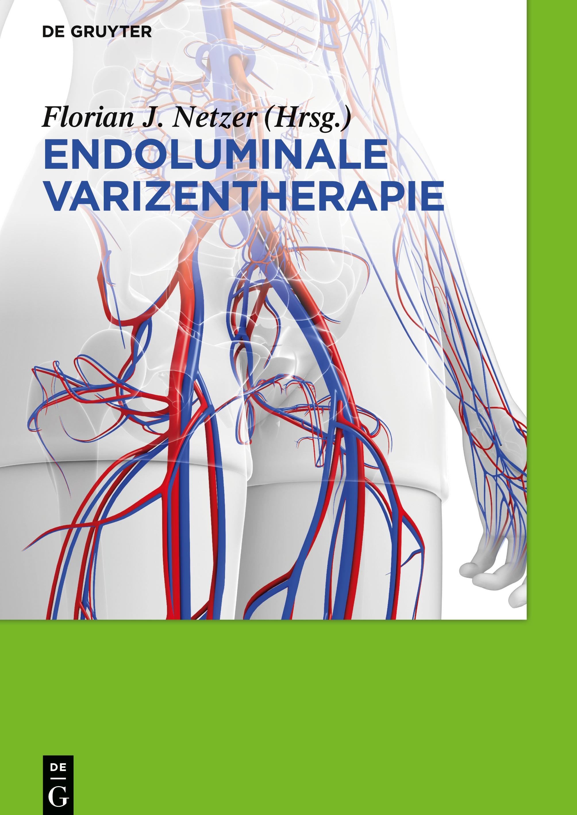 Endoluminale Varizentherapie