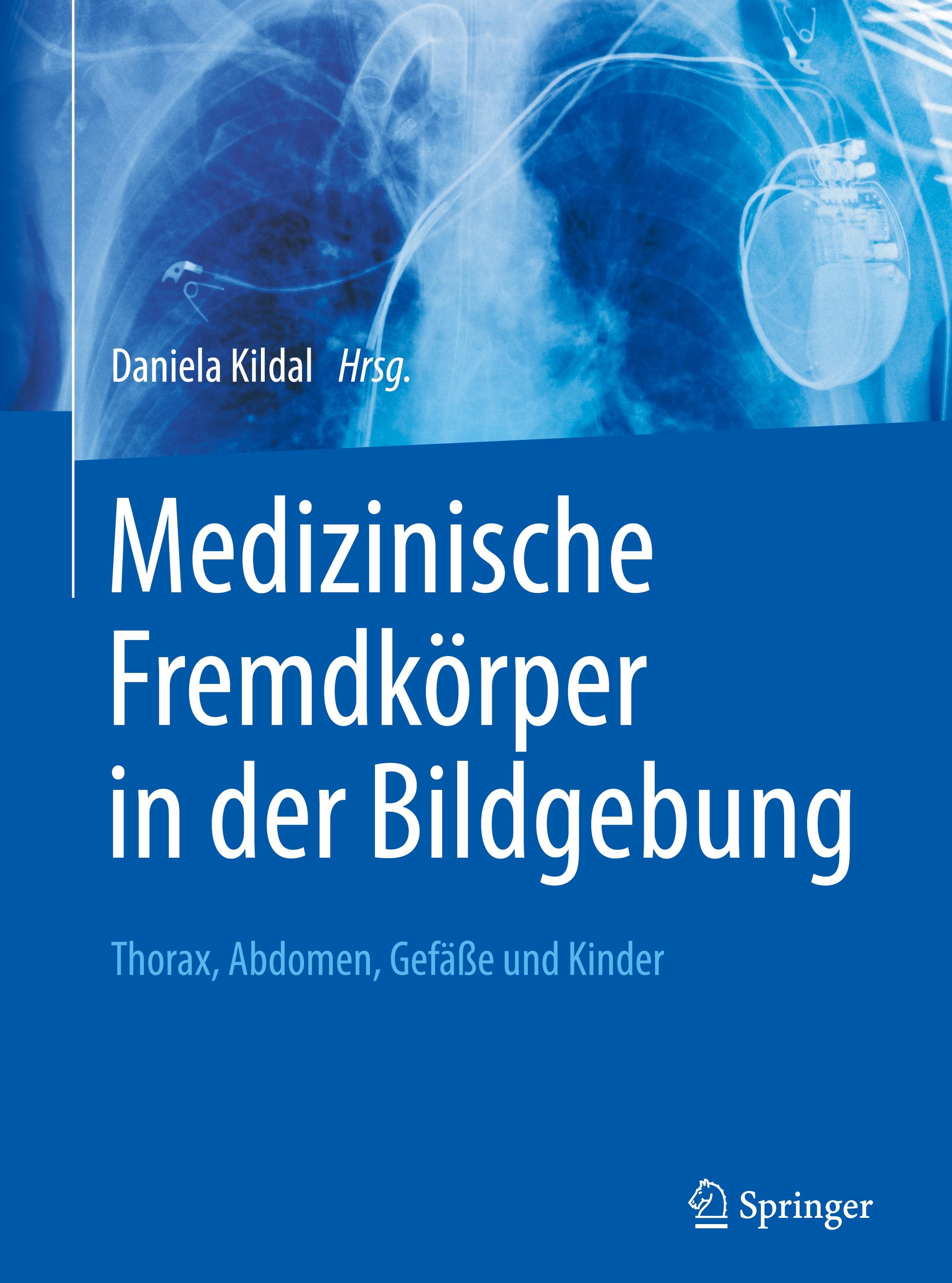 Medizinische Fremdkörper in der Bildgebung