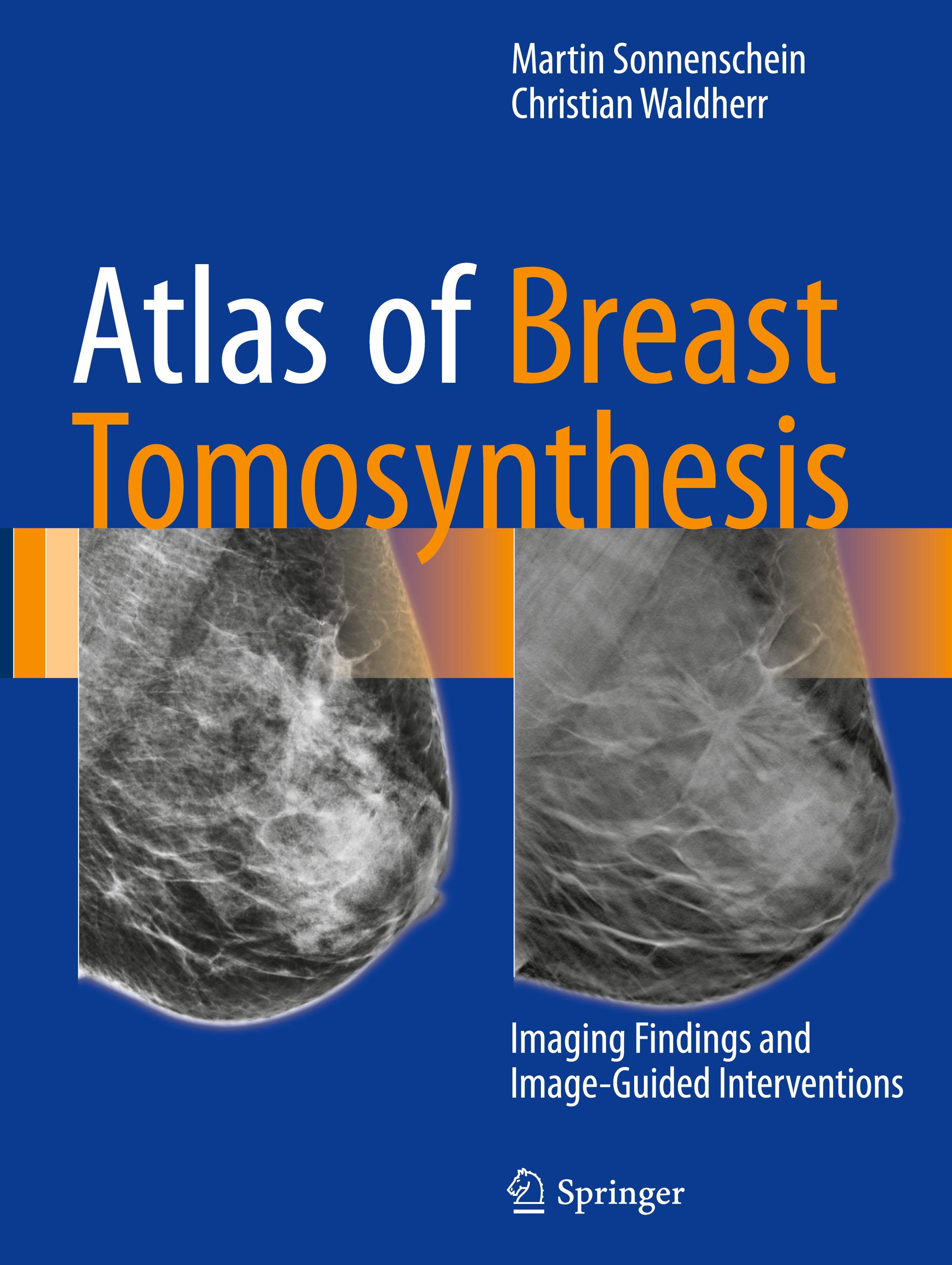 Atlas of Breast Tomosynthesis