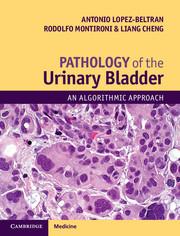 Pathology of the Urinary Bladder