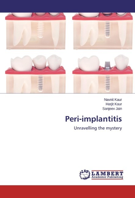 Peri-implantitis