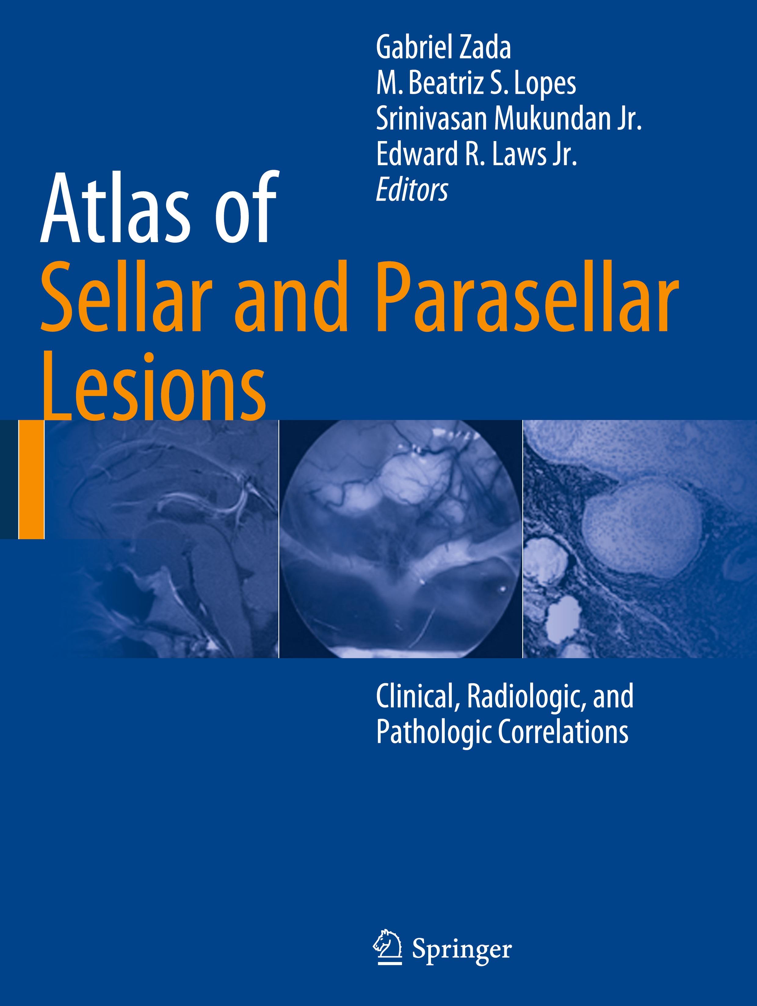 Atlas of Sellar and Parasellar Lesions