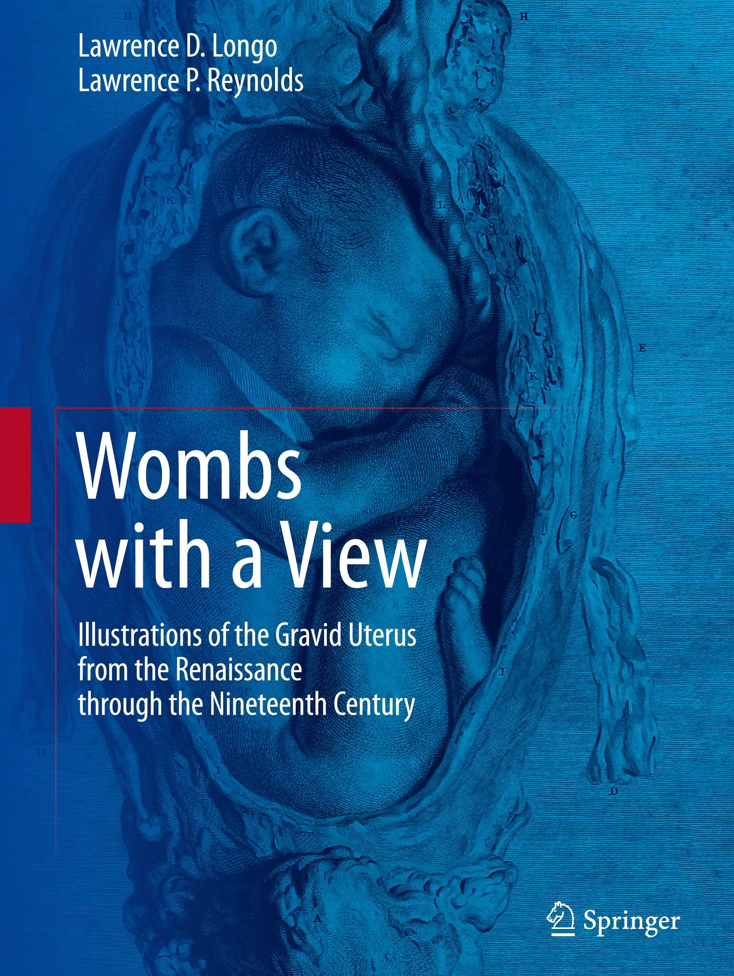 Wombs with a View