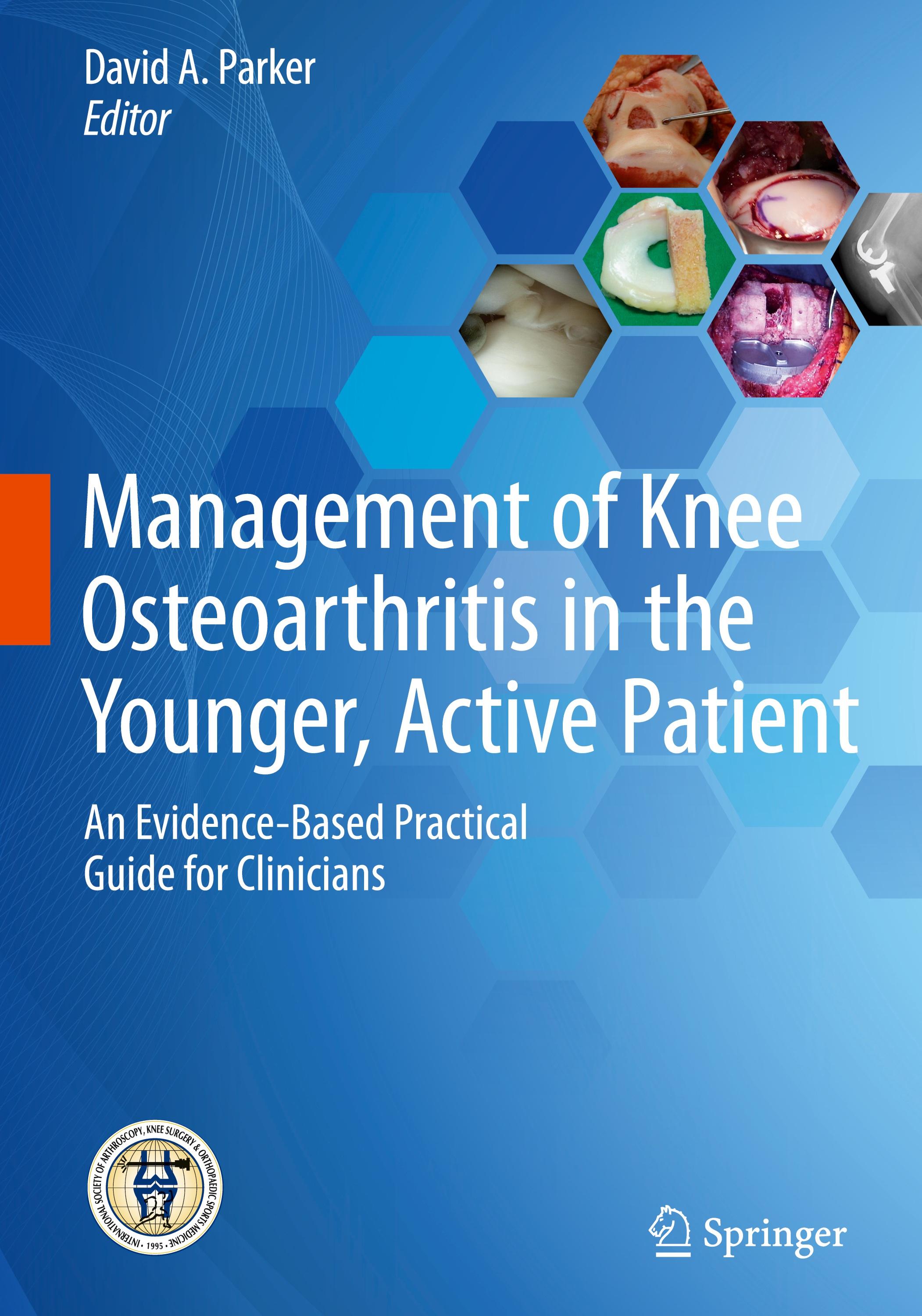 Management of Knee Osteoarthritis in the Younger, Active Patient