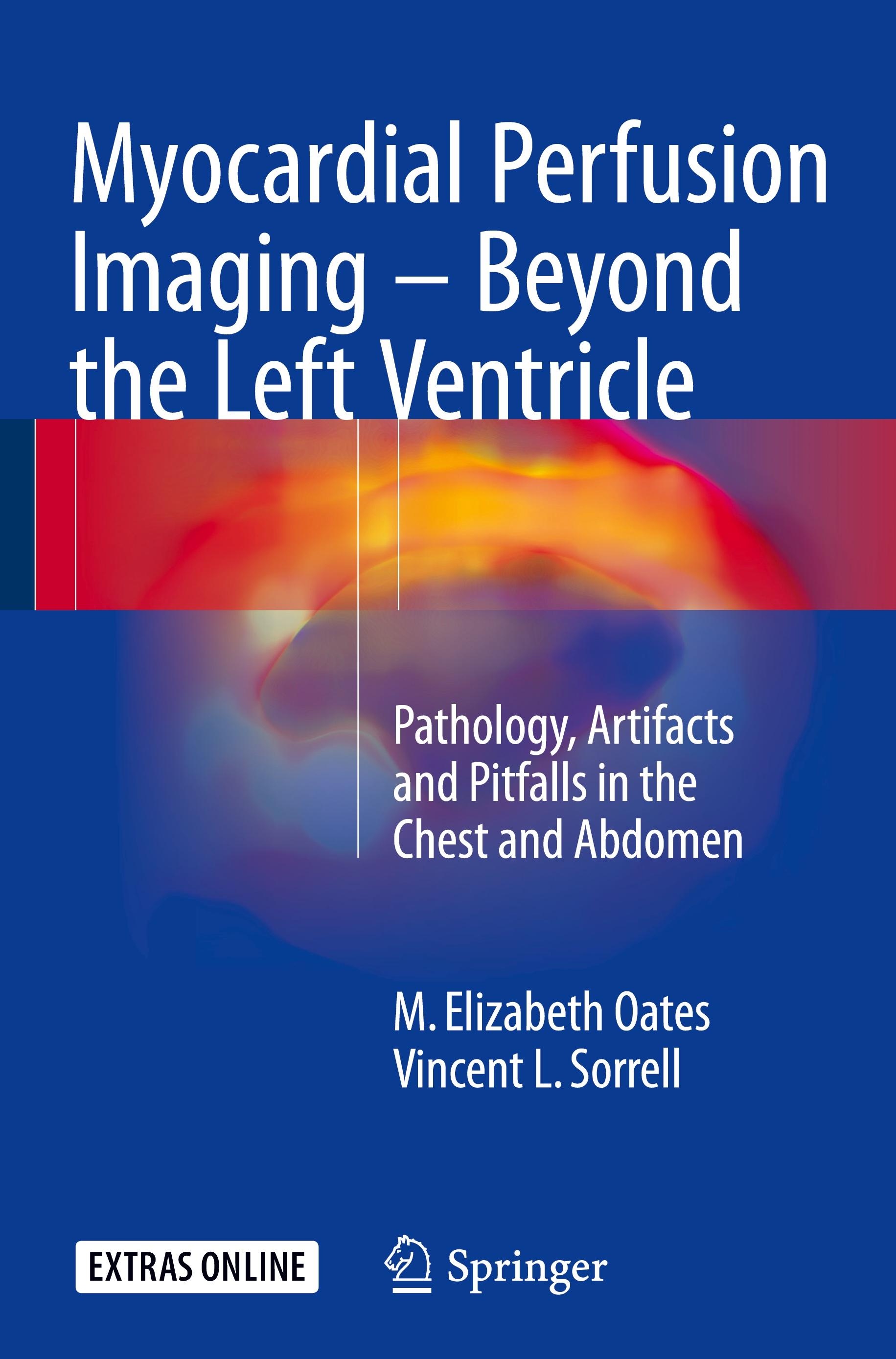 Myocardial Perfusion Imaging - Beyond the Left Ventricle