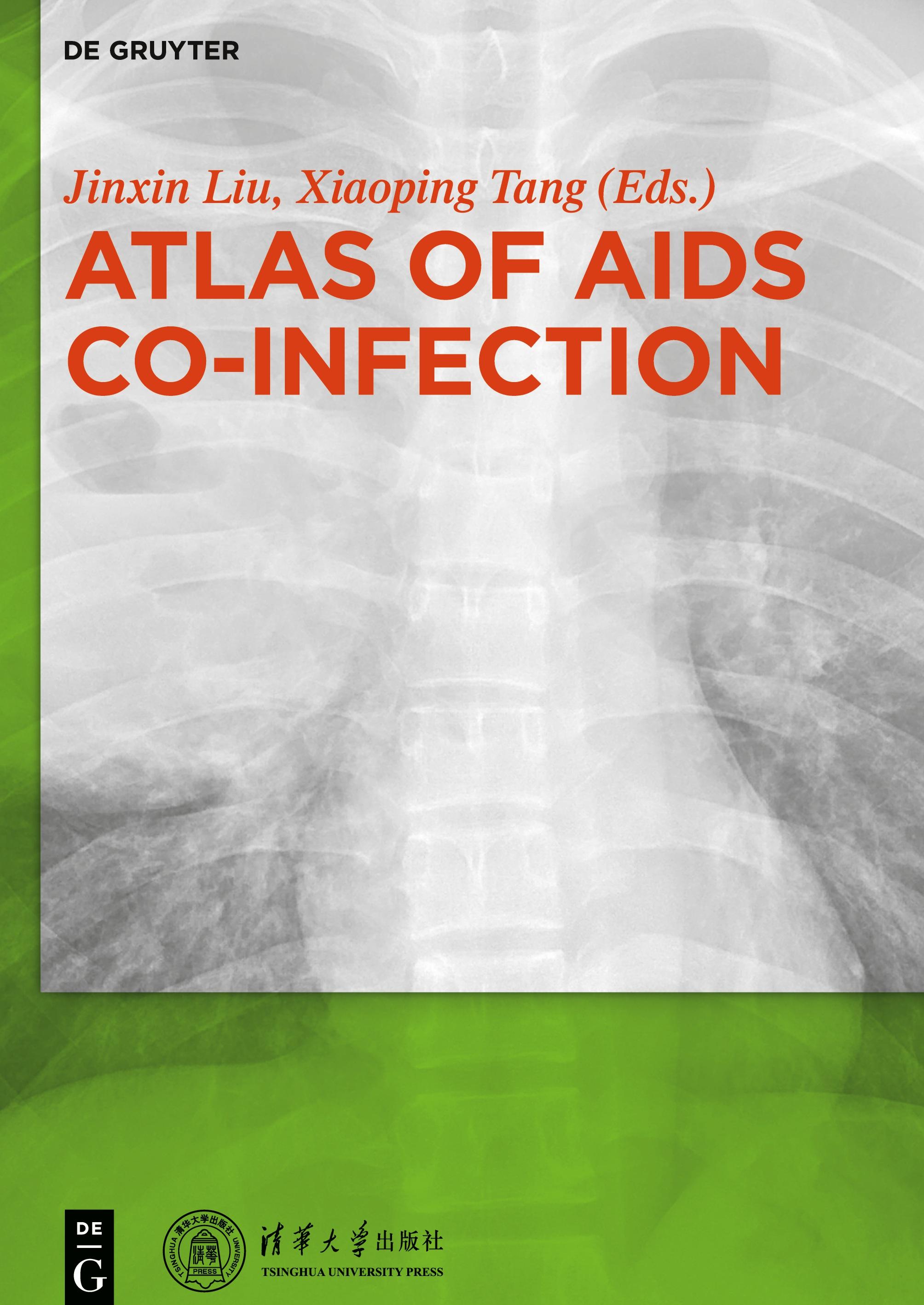 Atlas of AIDS Co-infection