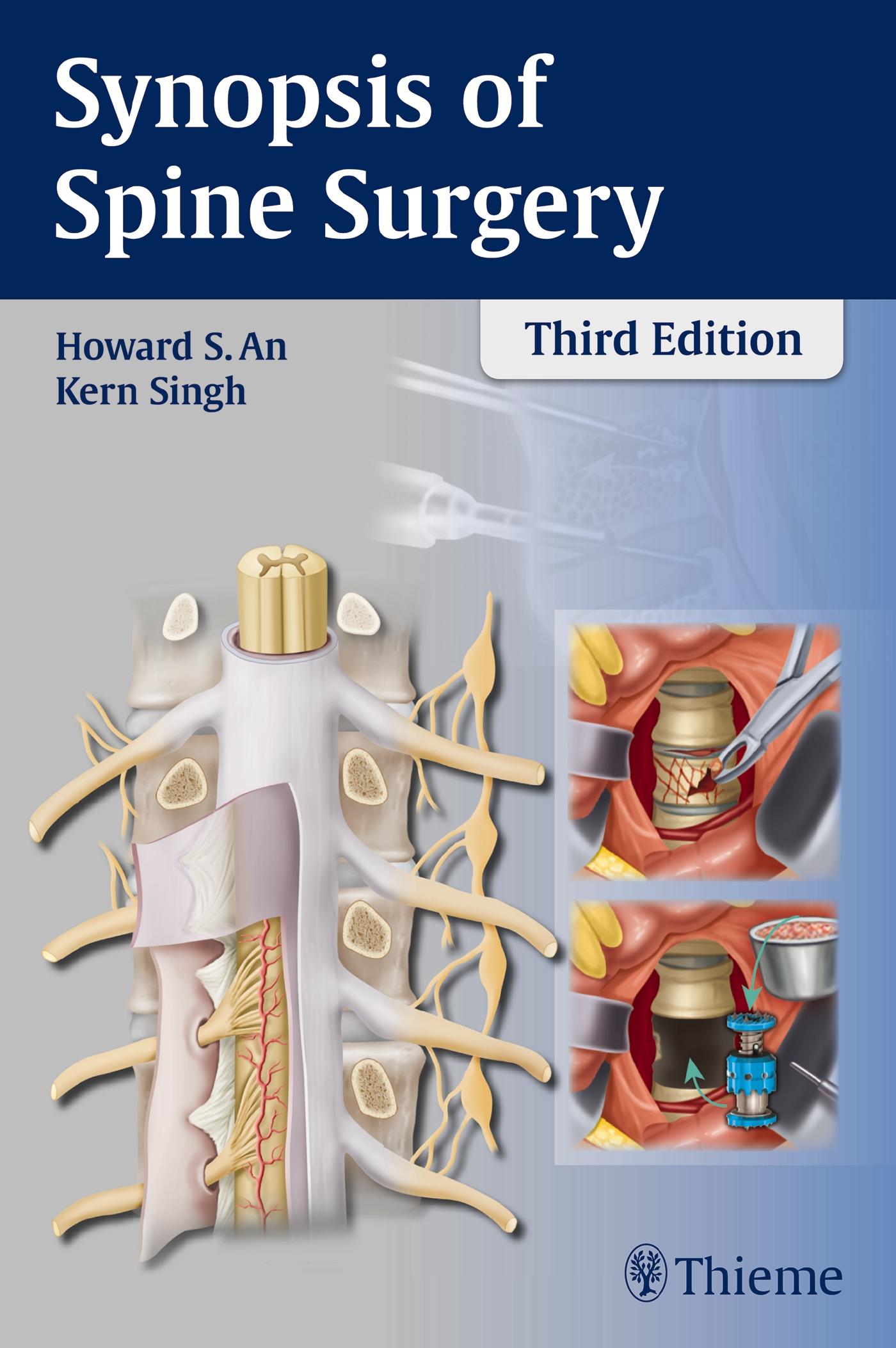 Synopsis of Spine Surgery